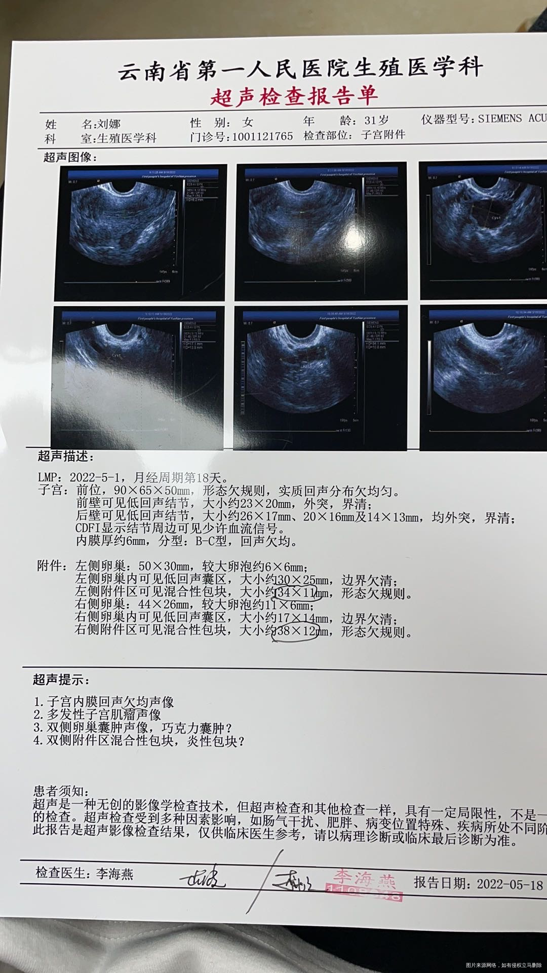 5月1号取卵九枚最后获得D3两枚D5两枚因为