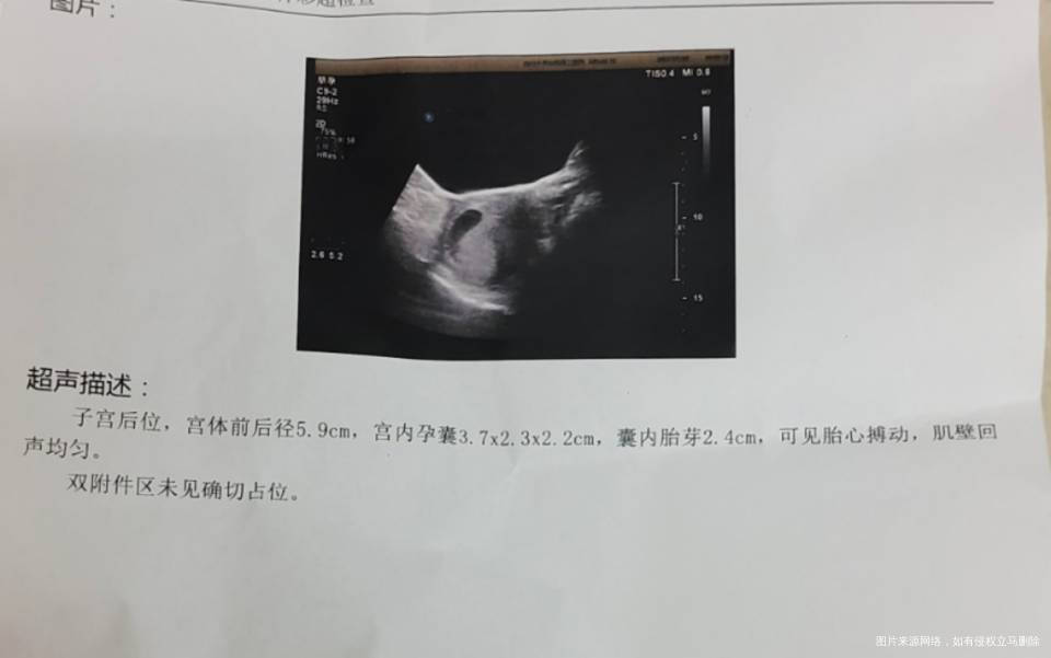 医生请问这大概是多少周孕囊是不是有点太小孕囊