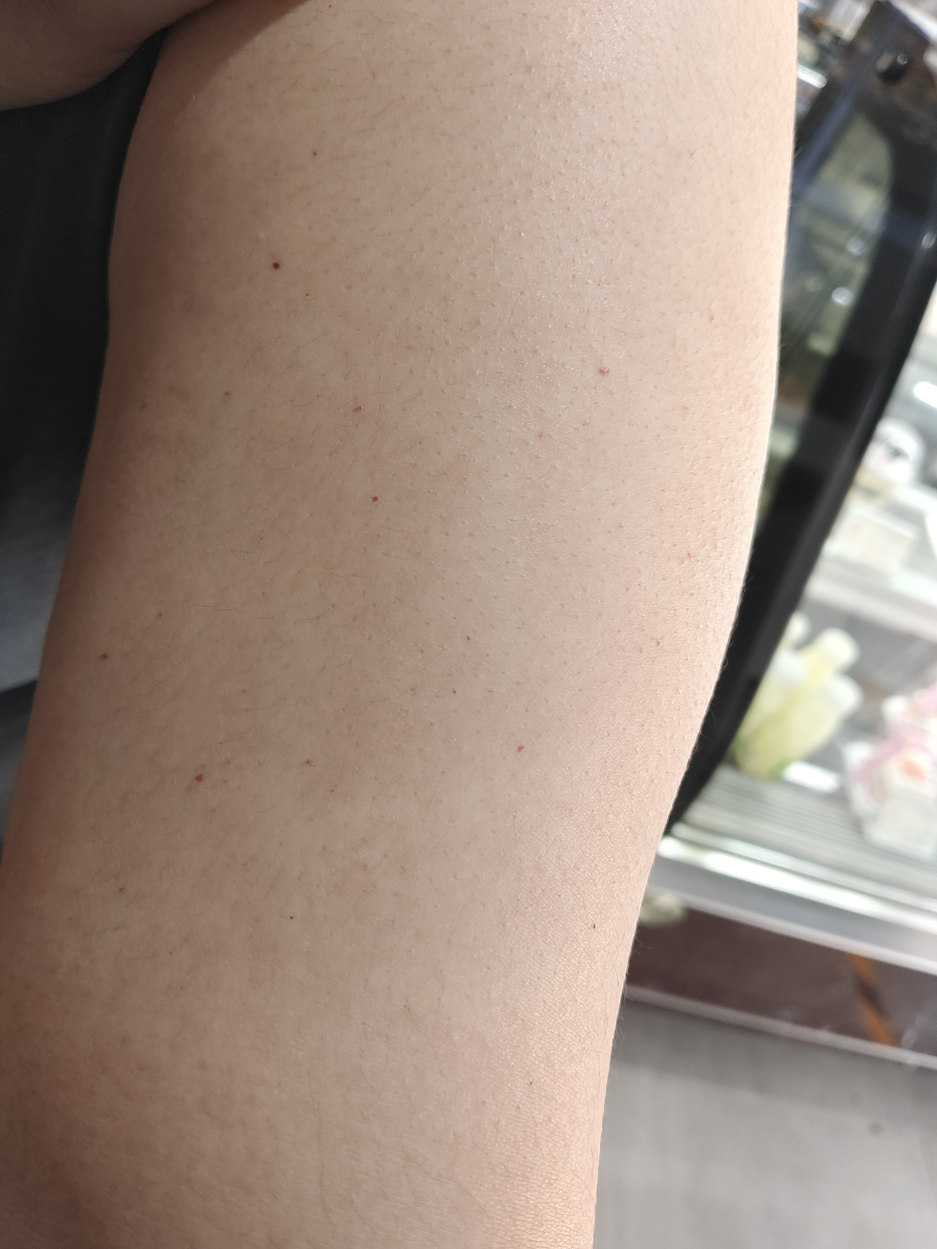 发现胳膊上长了红点点是怎么回事需要做什么检查