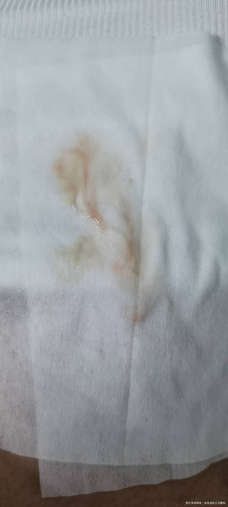 孕33周今早大便分泌物带点血丝没有腹痛偶尔有