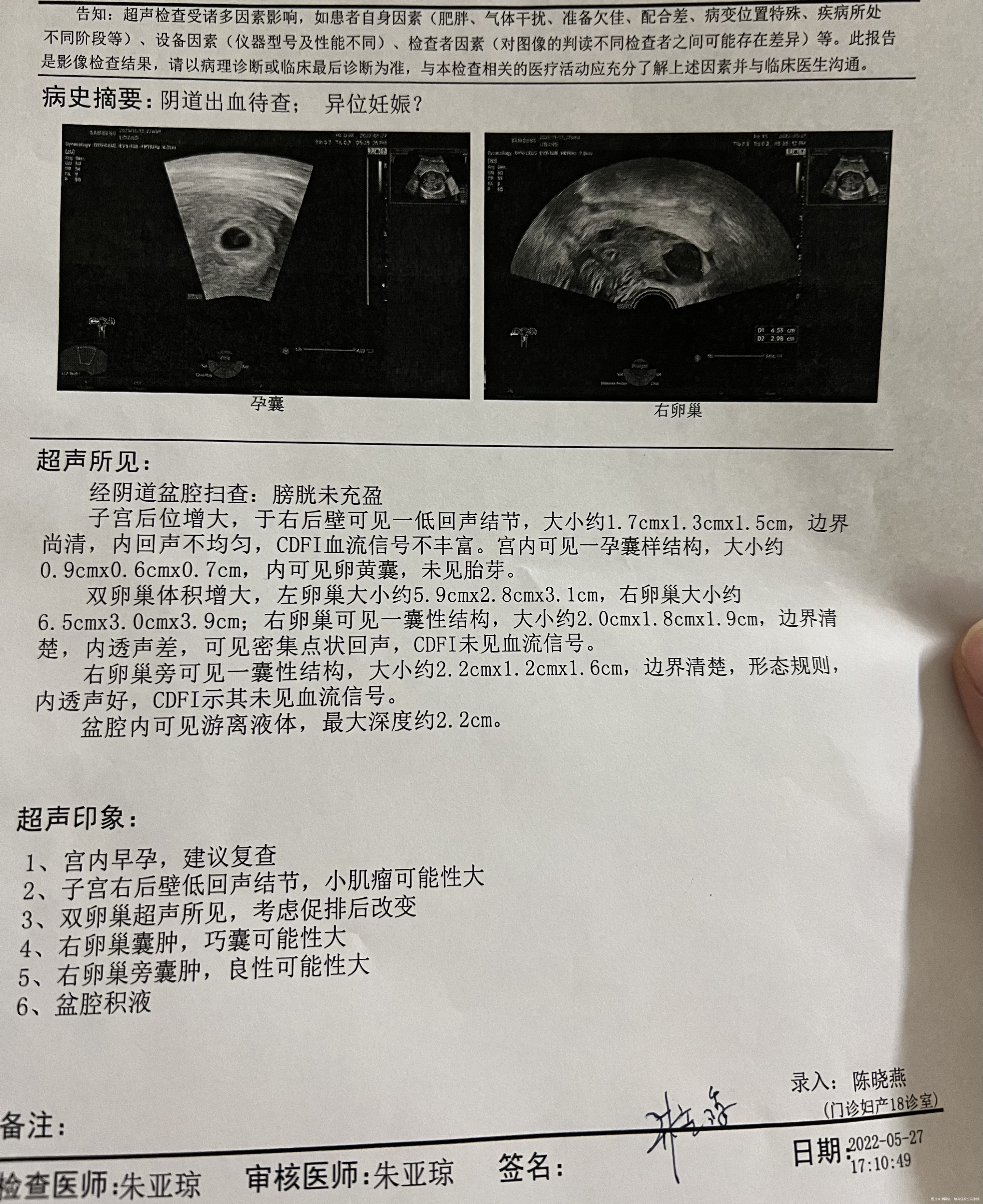 我5月3日移植的两枚鲜胚18天的时候出褐色的
