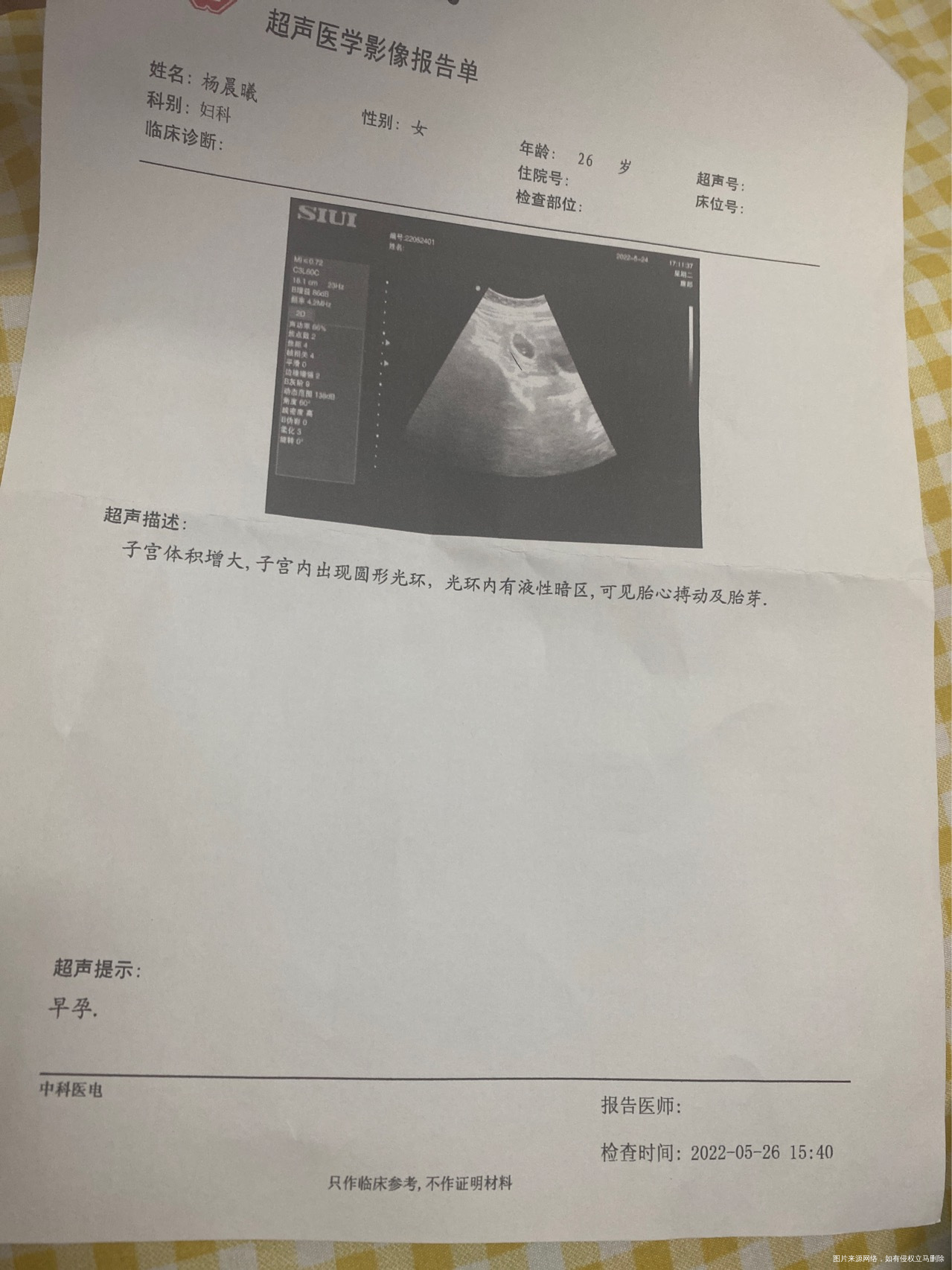 孕6周+6天今天下午流褐色分泌物了不算很多没