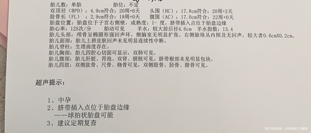 B超显示球拍状胎盘这样的胎盘该注意些什么