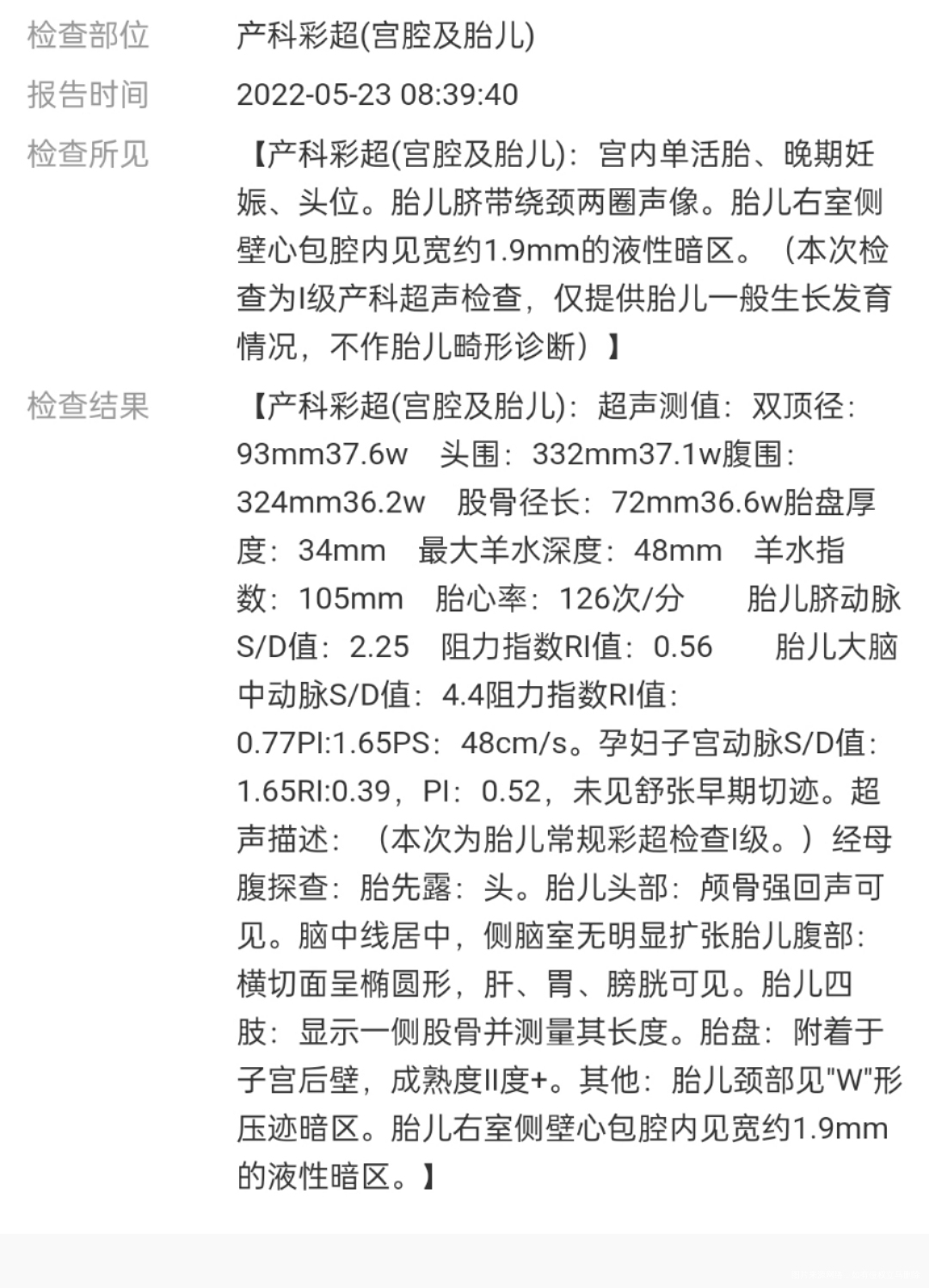 第38周这个应该怎么算胎儿大小现在的是多大呀