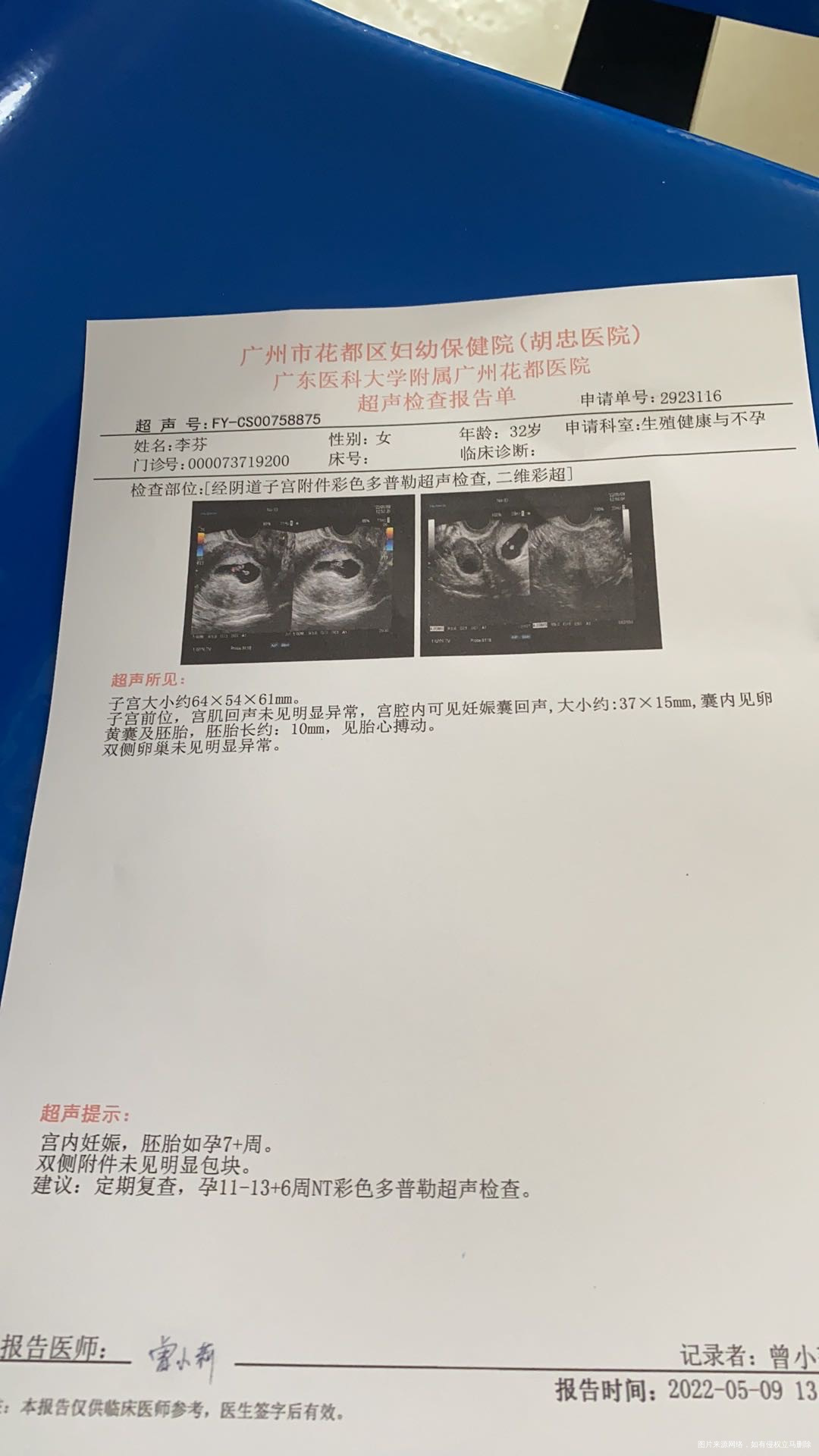 2号到7号的帮我看下正常吗