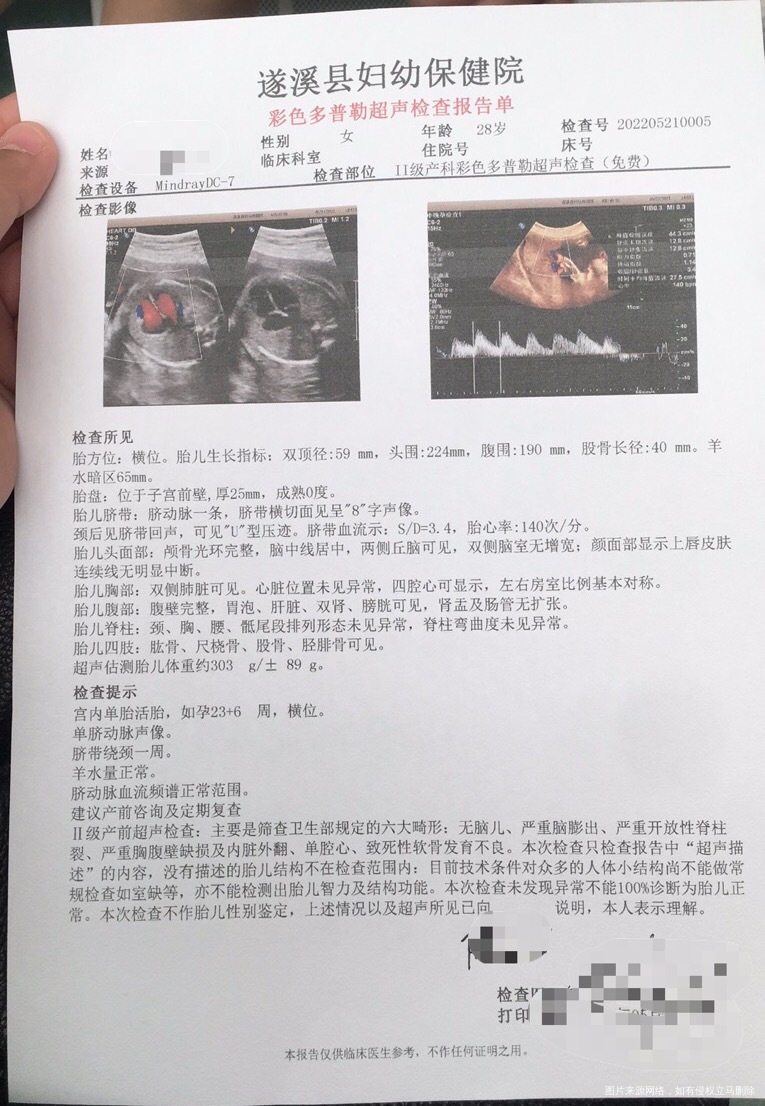 脐带一周听说两周才正常咯怎么办才好报告显示还