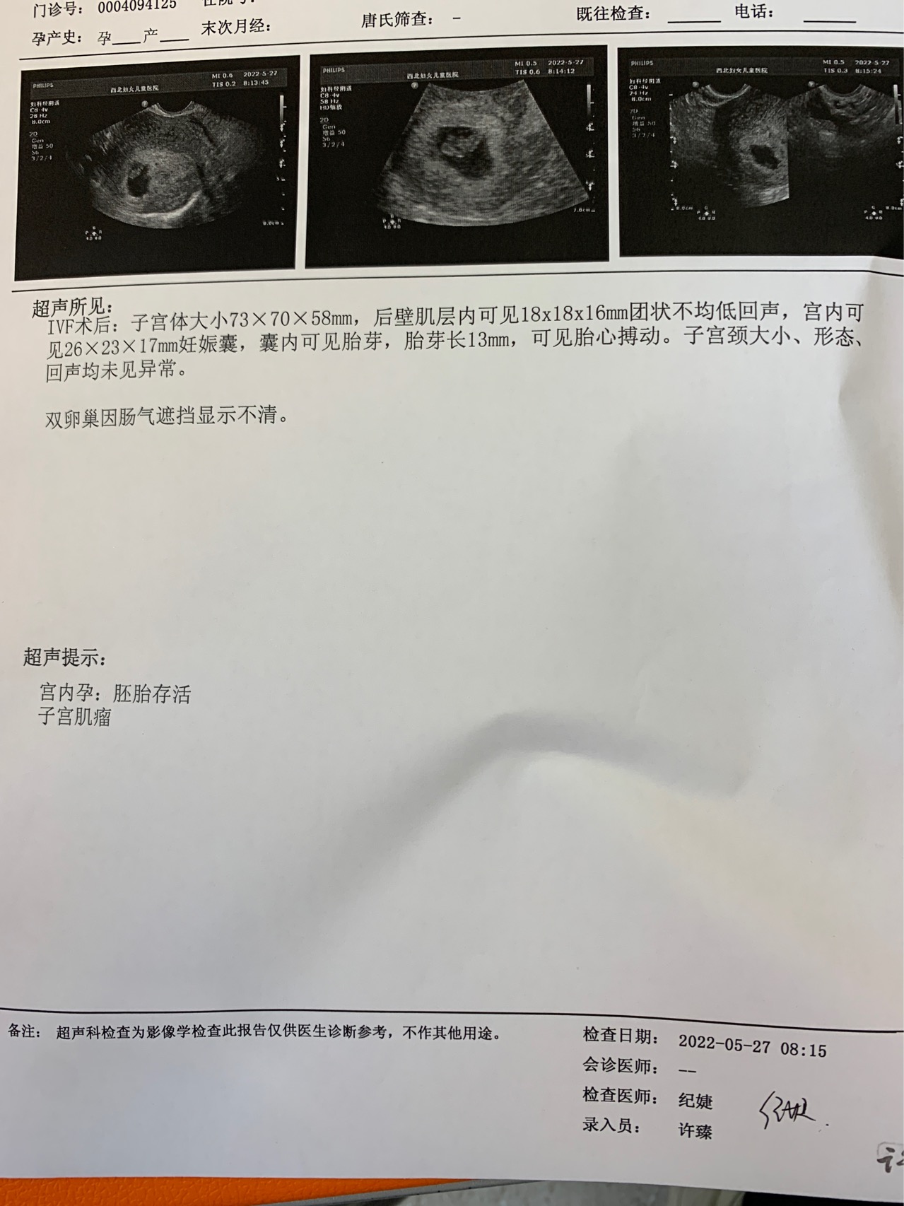 今天孕7周➕5天昨晚有点褐色分泌物到凌晨就成