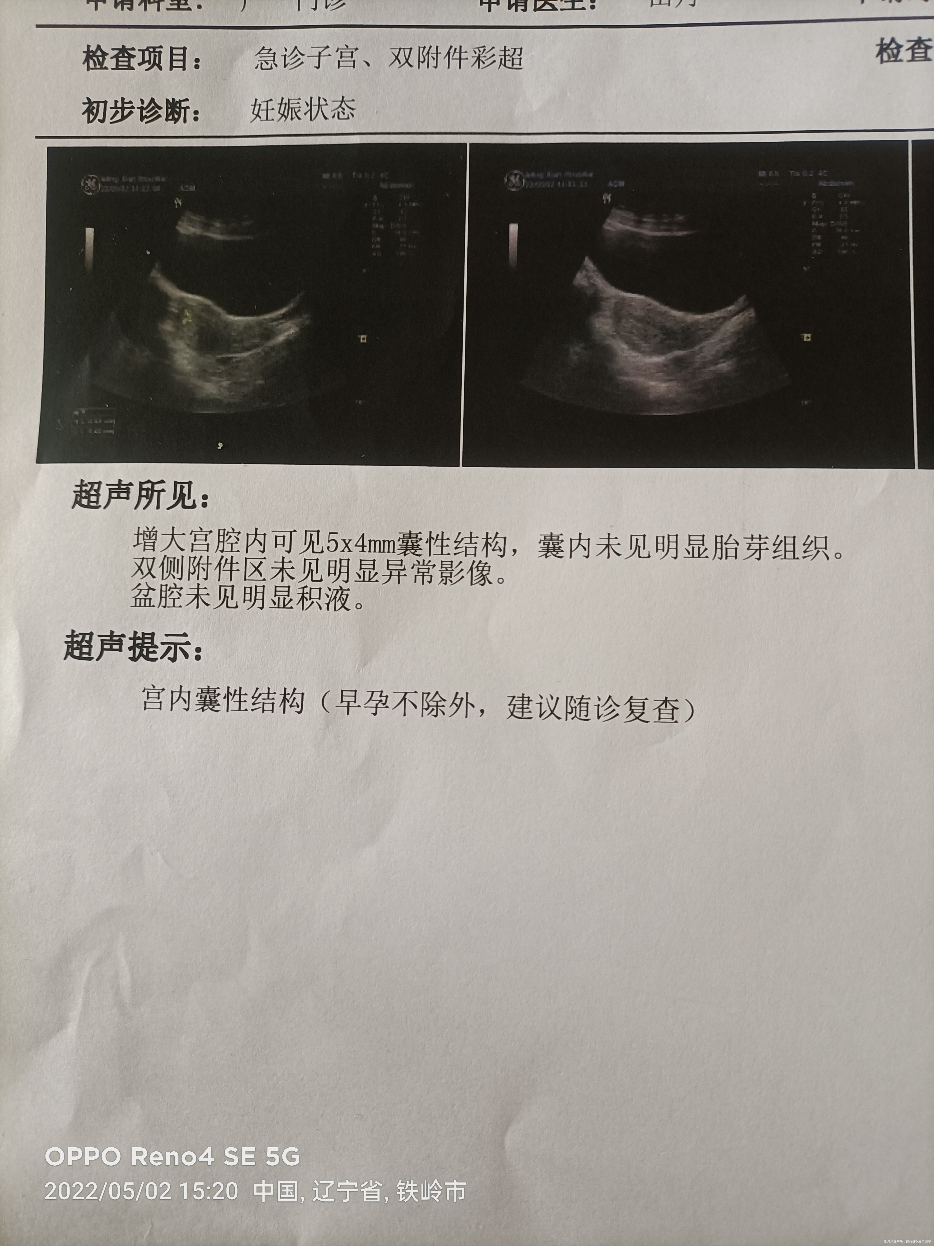这个值正常么末次月经3月19日