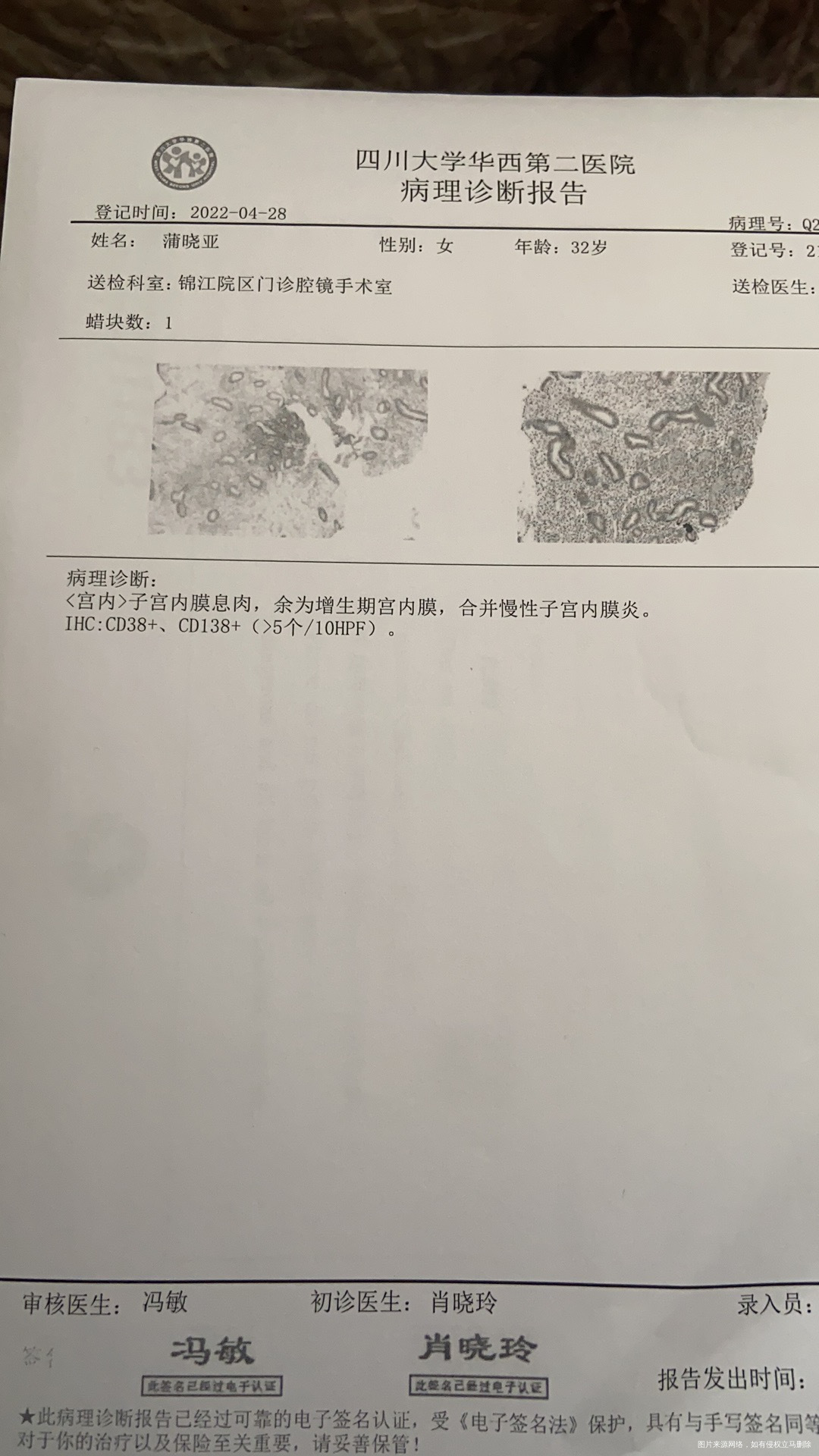 这个情况服用盐酸酸多西环素两周妇科千金片两周