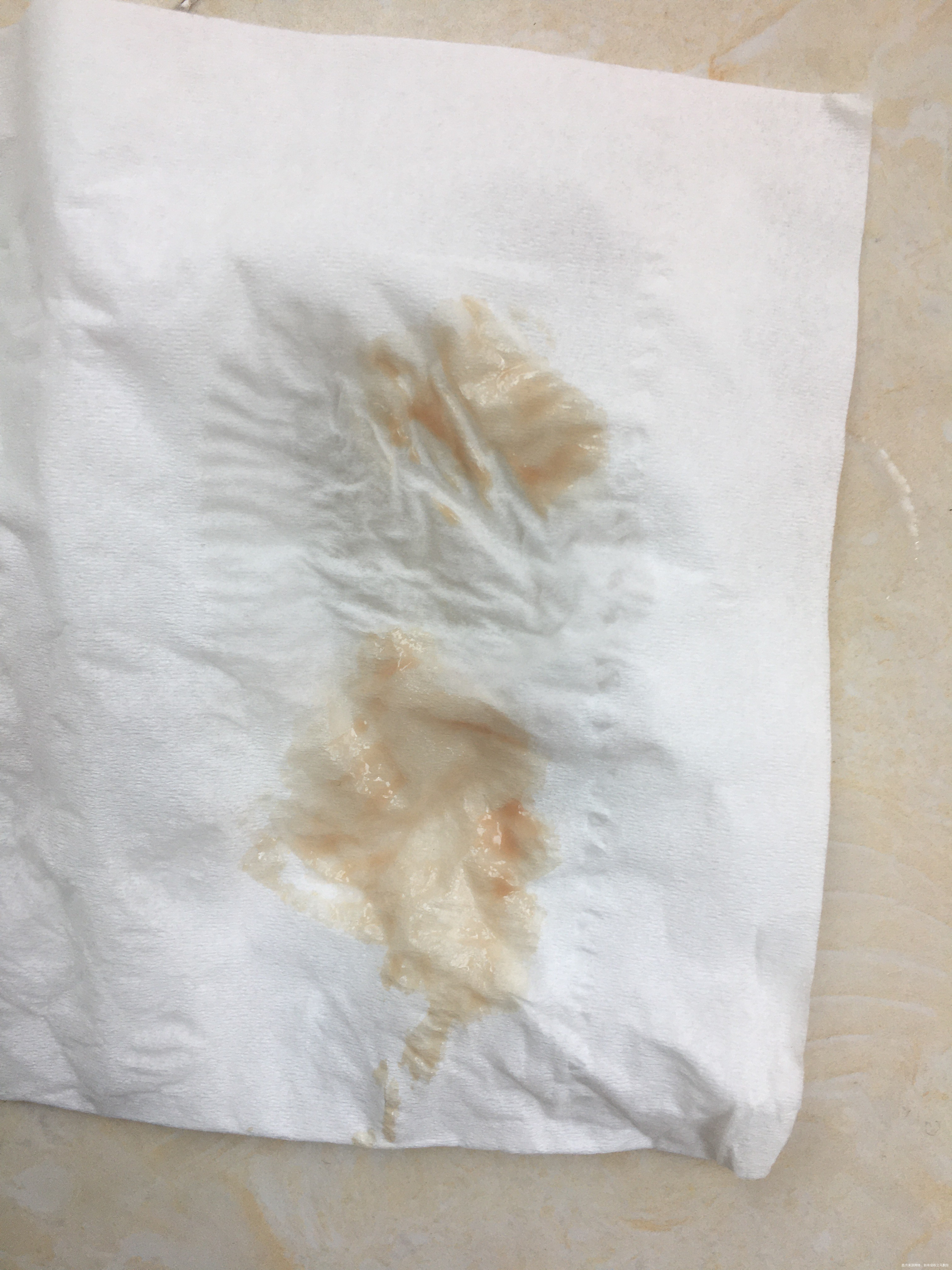 329试管移植的昨天今天都有一点出血目前是吃