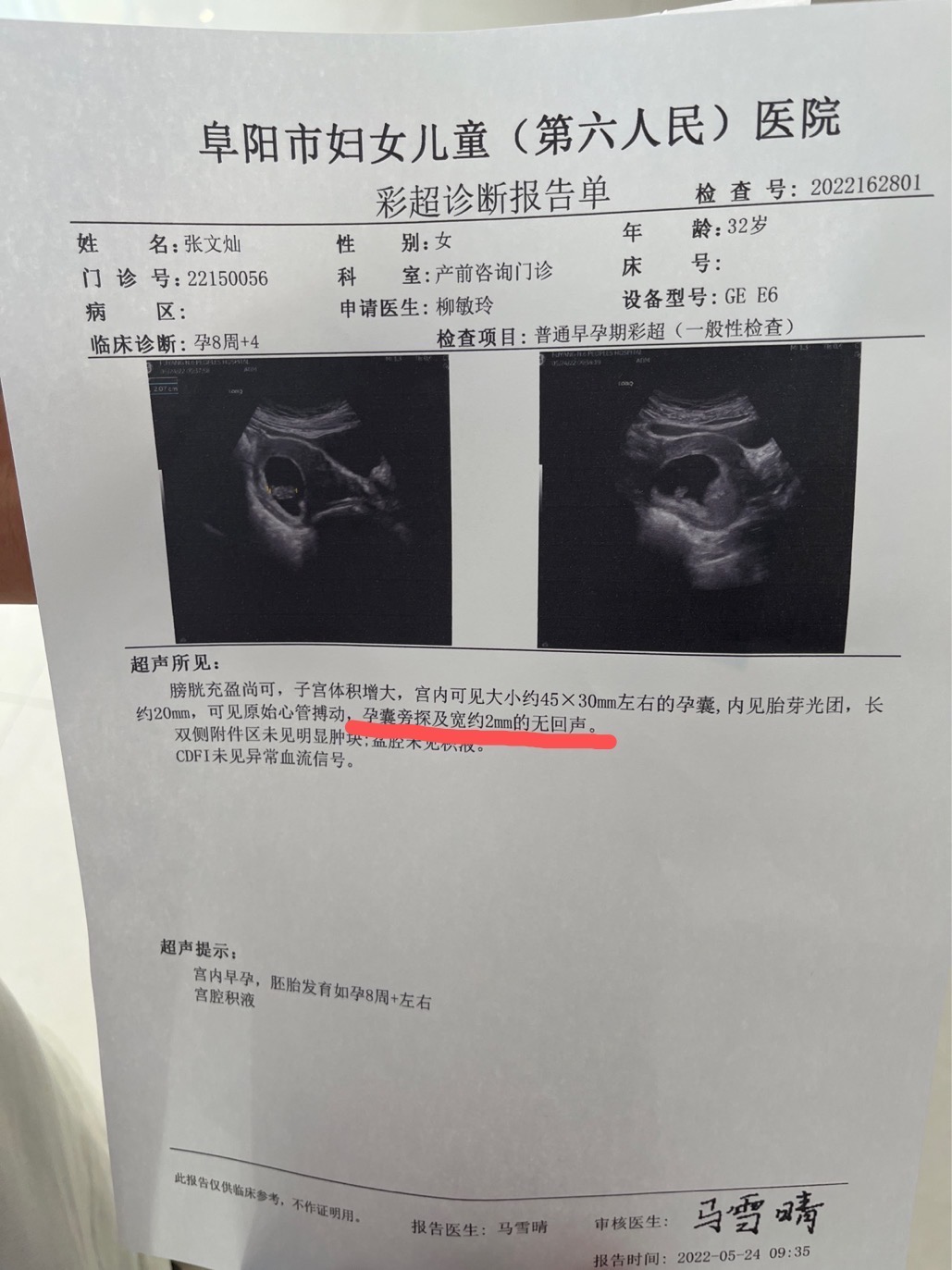 移植40天的b超好担心啊