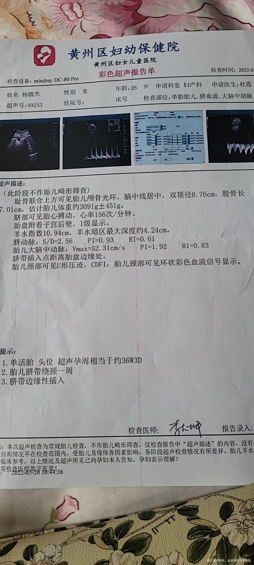 请帮我看看B超单子结果正不正常