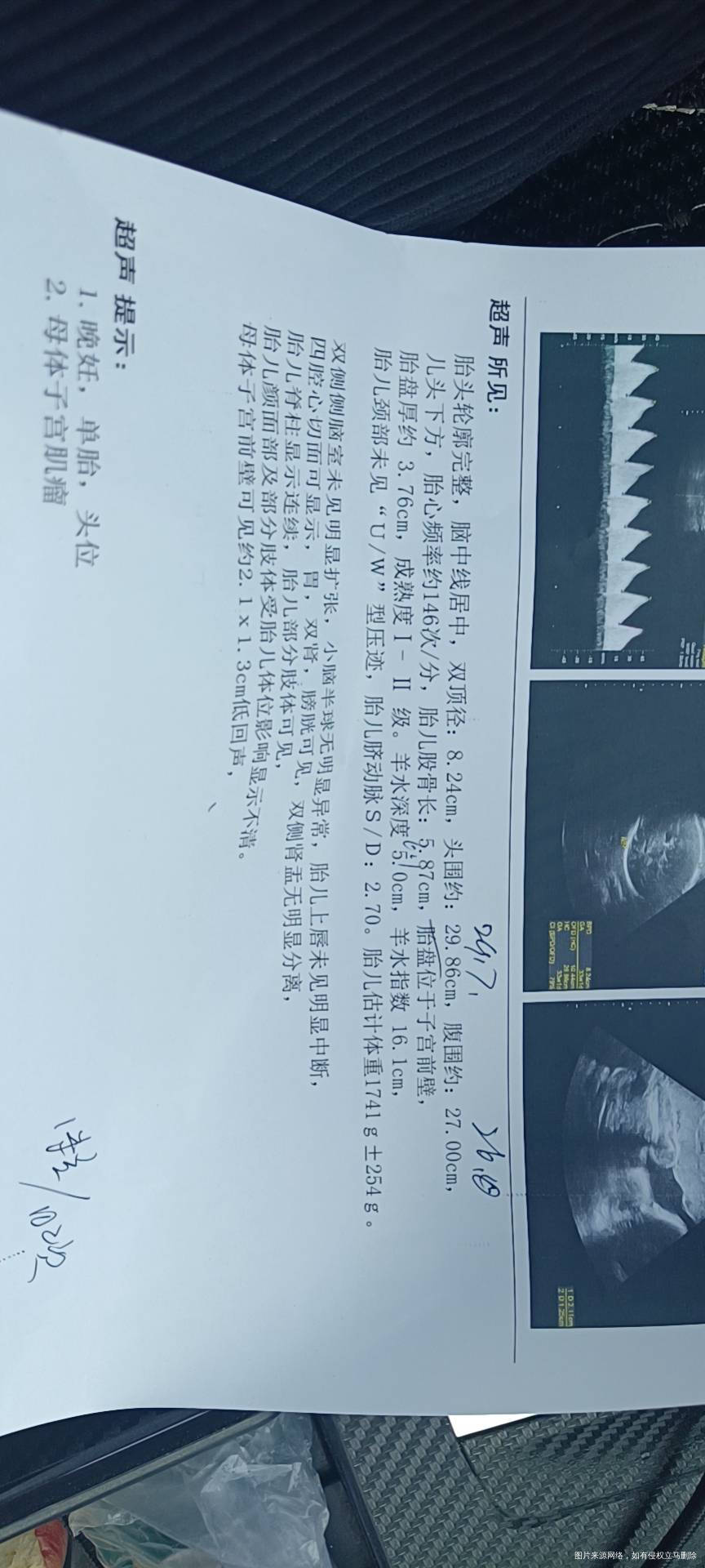 32+4是不是有点小啊股骨短很多吗