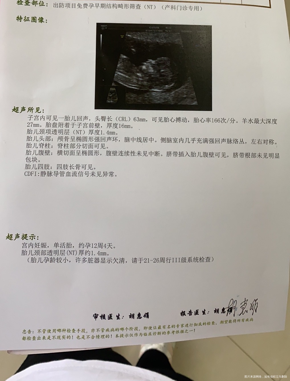 今天12周4天NT已过快下班了医生给我开了好