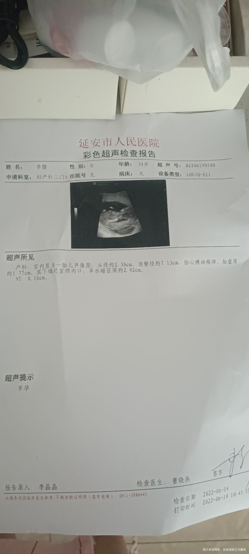 怀孕13+3周产检医生说胎盘有点低羊水有点少