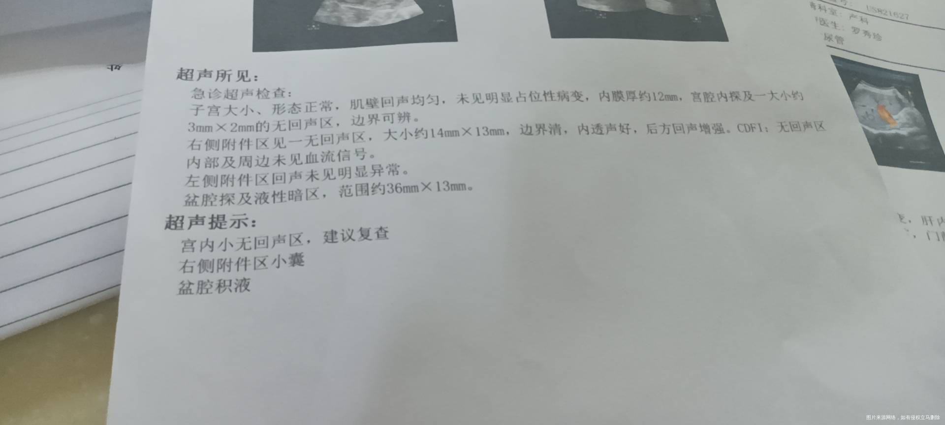 麻烦医生帮我看一下报告单