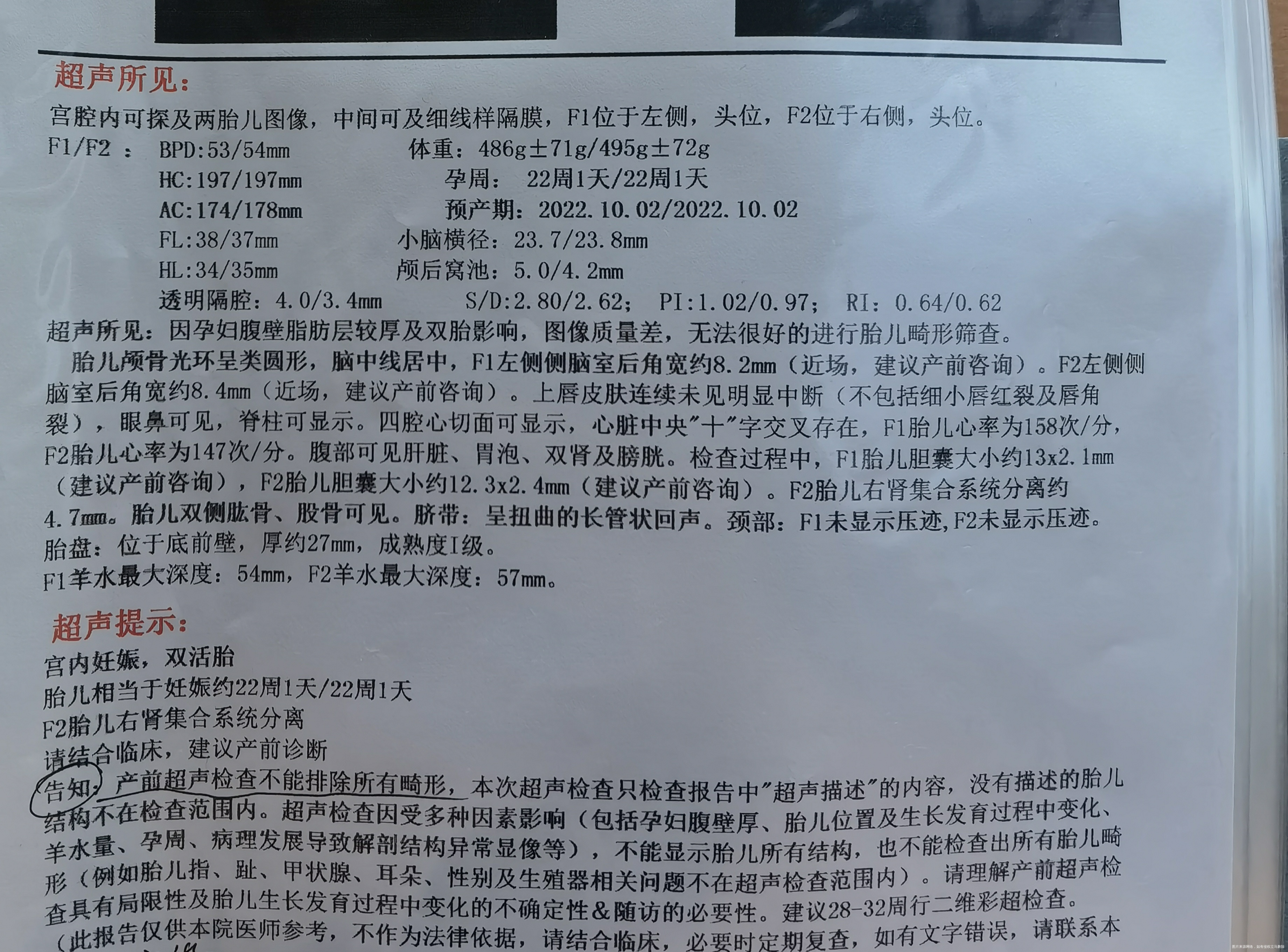 孕22周➕1年龄27四维彩超有问题吗