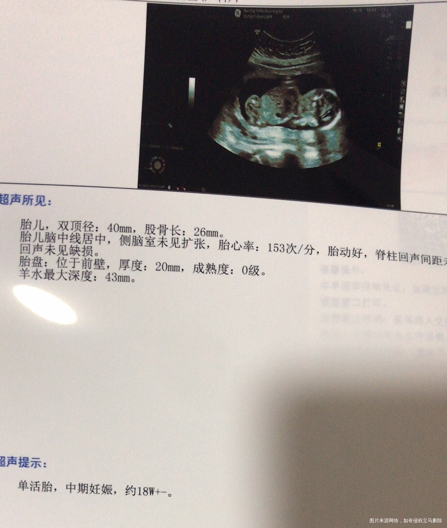 从怀孕到现在20周每天晚上肚子坠坠的痛腰酸就