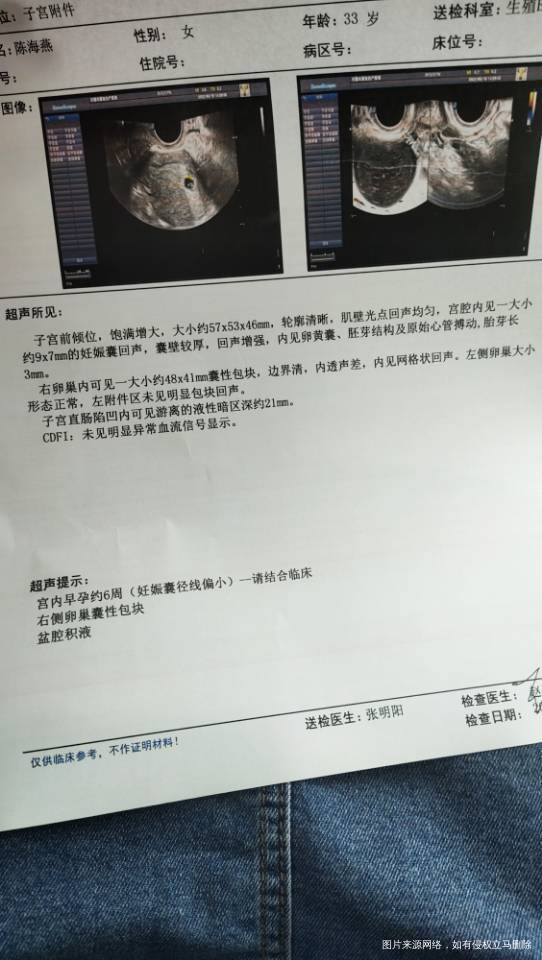 妊娠囊径线偏小是什么意思呀孕酮也很低该怎么保