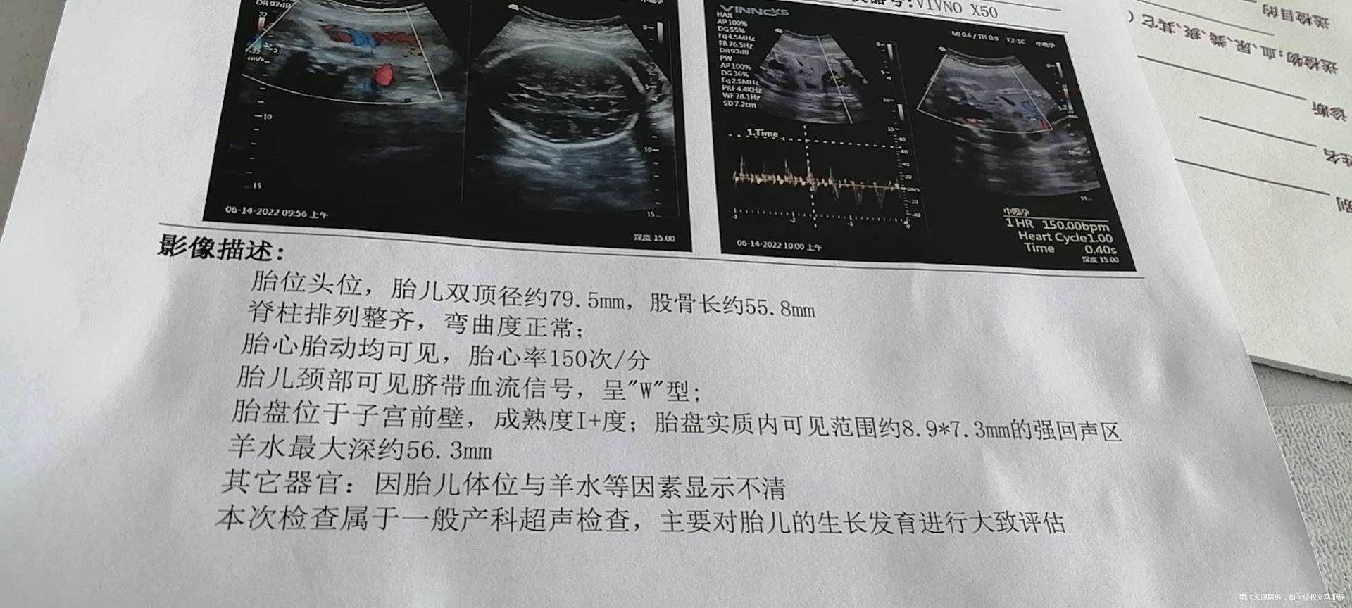 胎盘上无回声区咋回事8厘米x9厘米强烈回声区