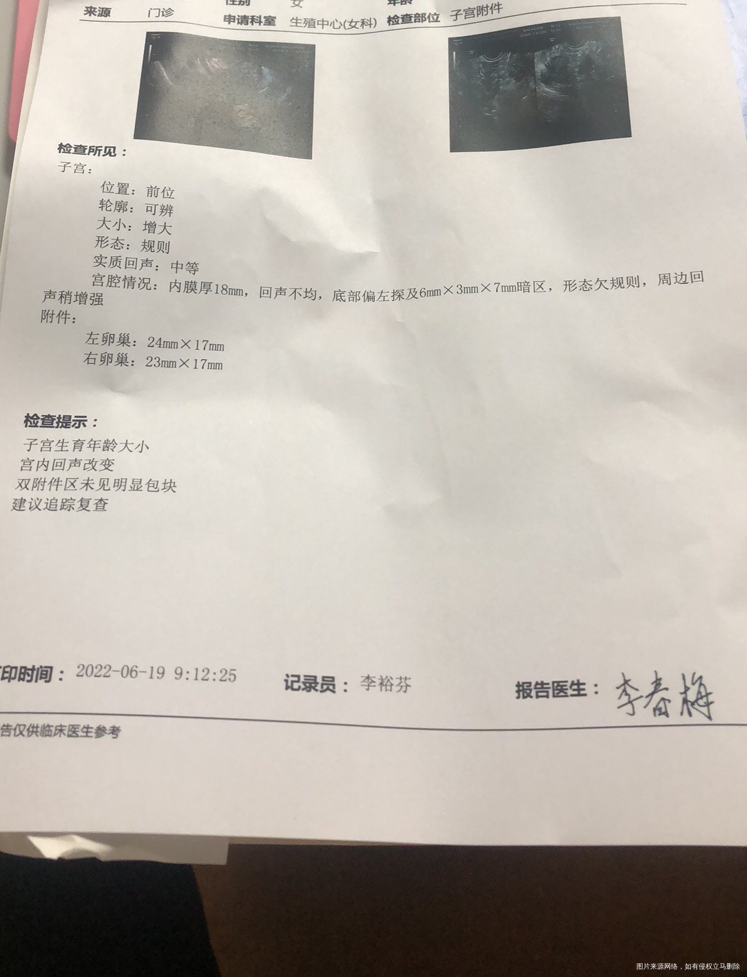 末次52了今天B超是这样翻倍挺好B超是不是发