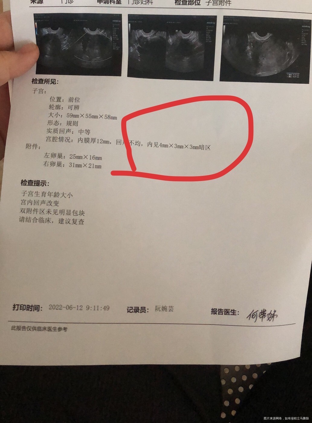 末次52日8号测出双杠12号去做第一次检查孕