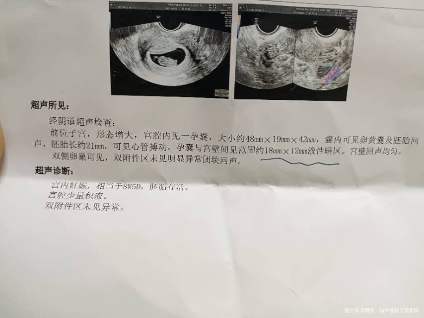 这种问题大吗一直都吃着孕酮片6+5一超都没有