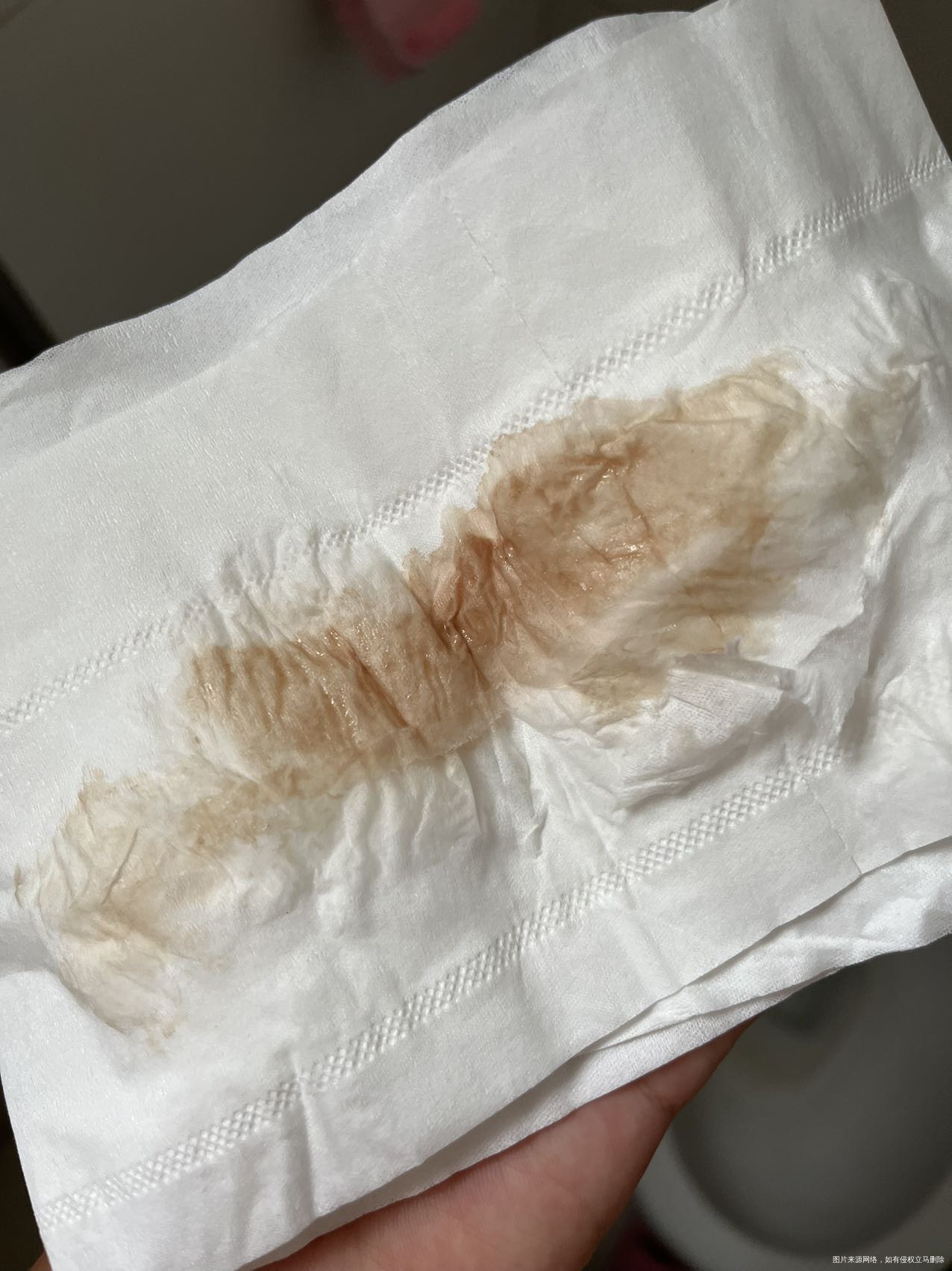 现在孕16周之前流过褐色分泌物然后医生开了十