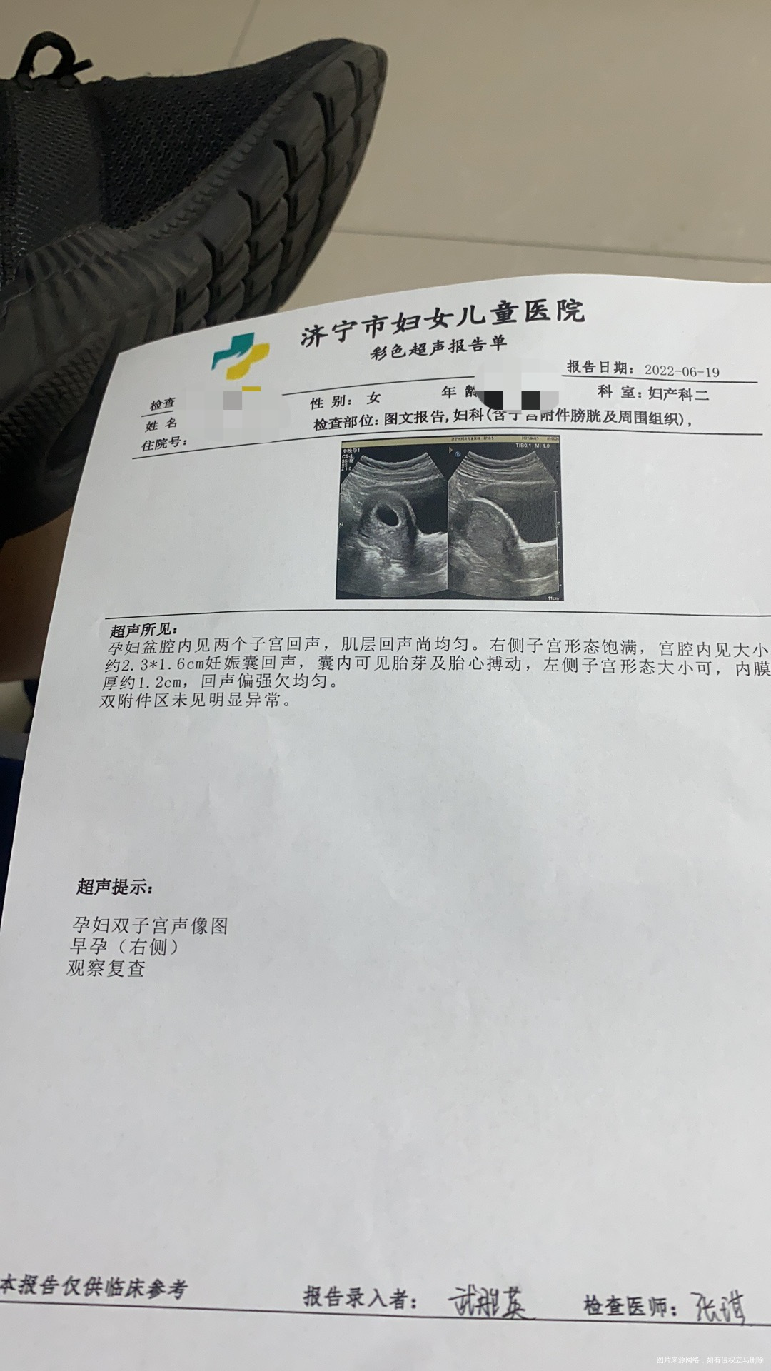 孕六周有时候小腹疼一阵一阵的今天忘记问了各位