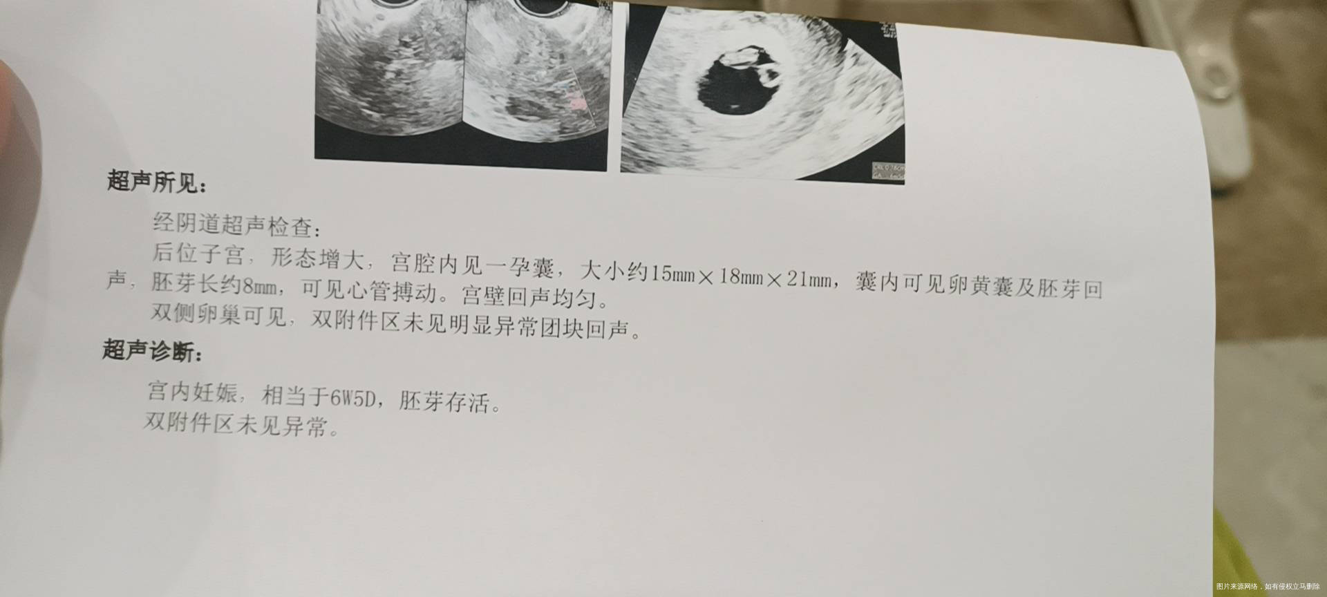 图1后续6月7号抽血hcg62299孕酮19