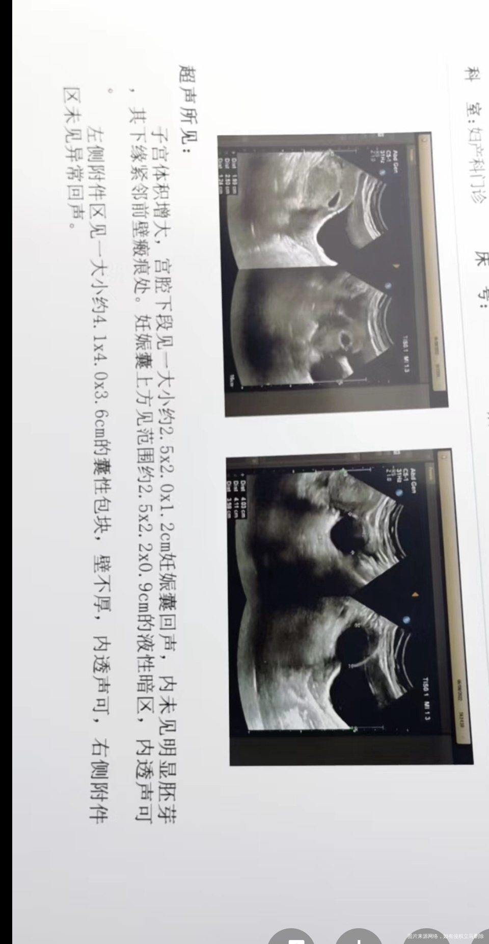 想要三胎长在刀口边上了这种可以要吗