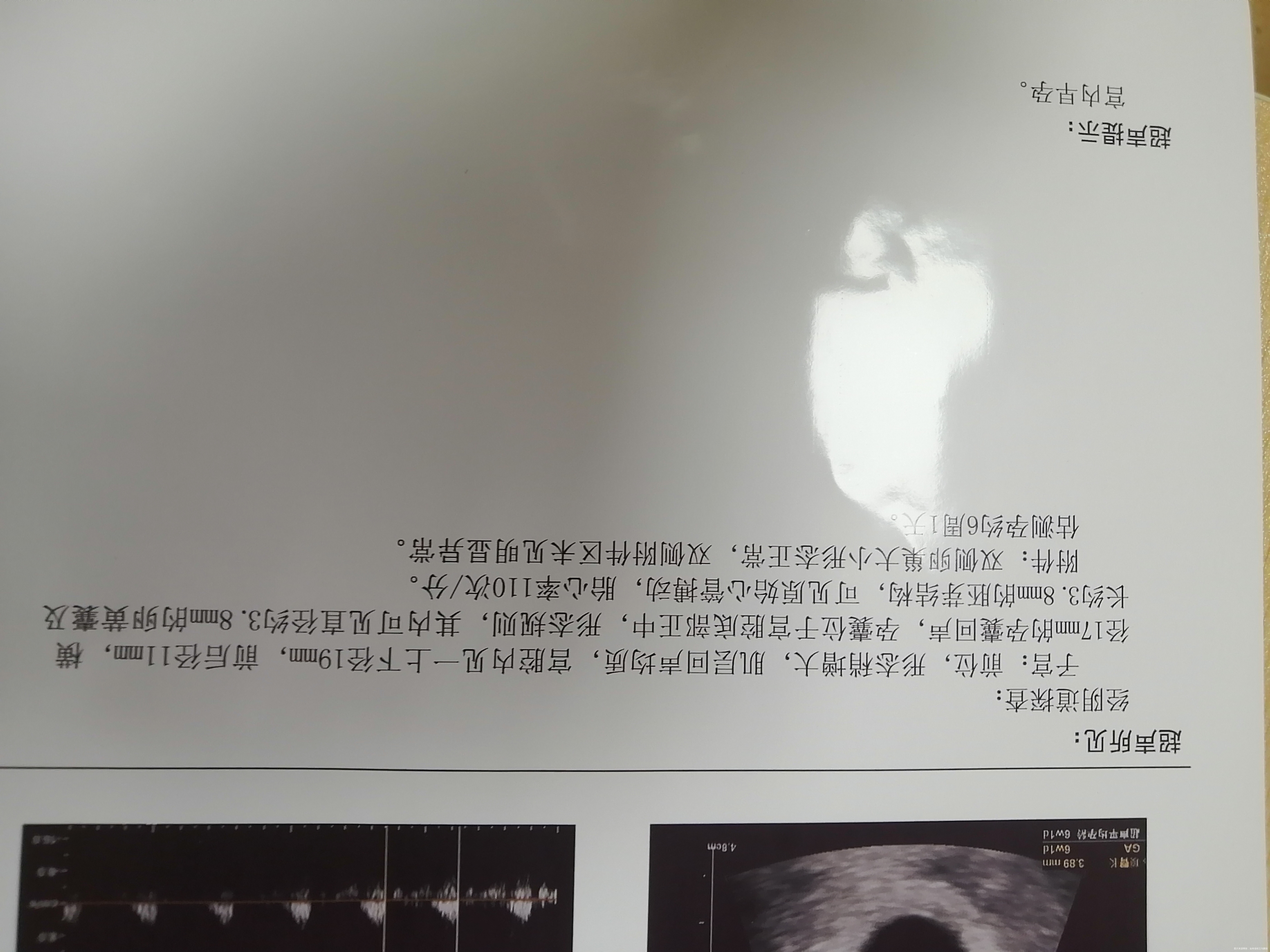 医生帮我看一下我这个血值和B超能对应上吗胎心