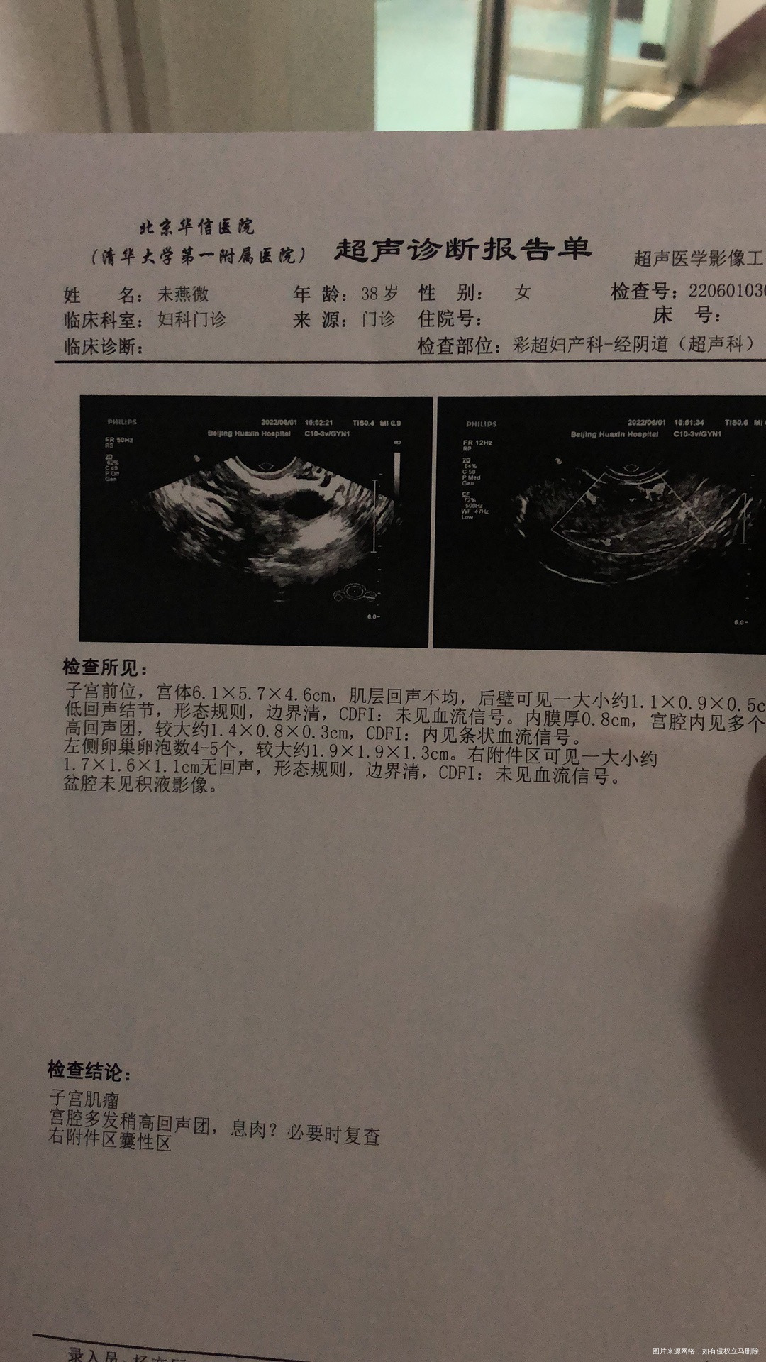 这是我检查的雌二醇低我该怎么办我下个月进周期