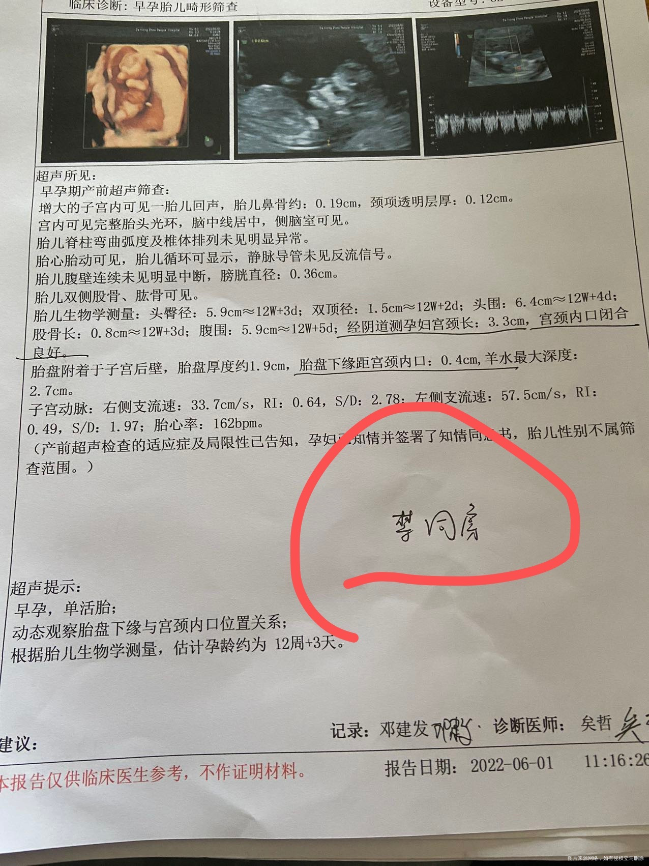 多囊促排怀孕有胎停史从怀孕就开始吃地屈孕酮片