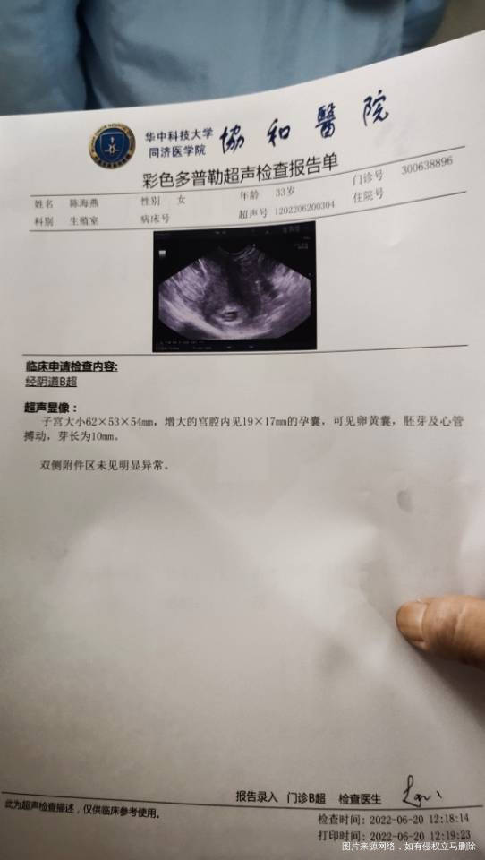 孕早期请问这个抗B2糖蛋白1抗体IGM高了是