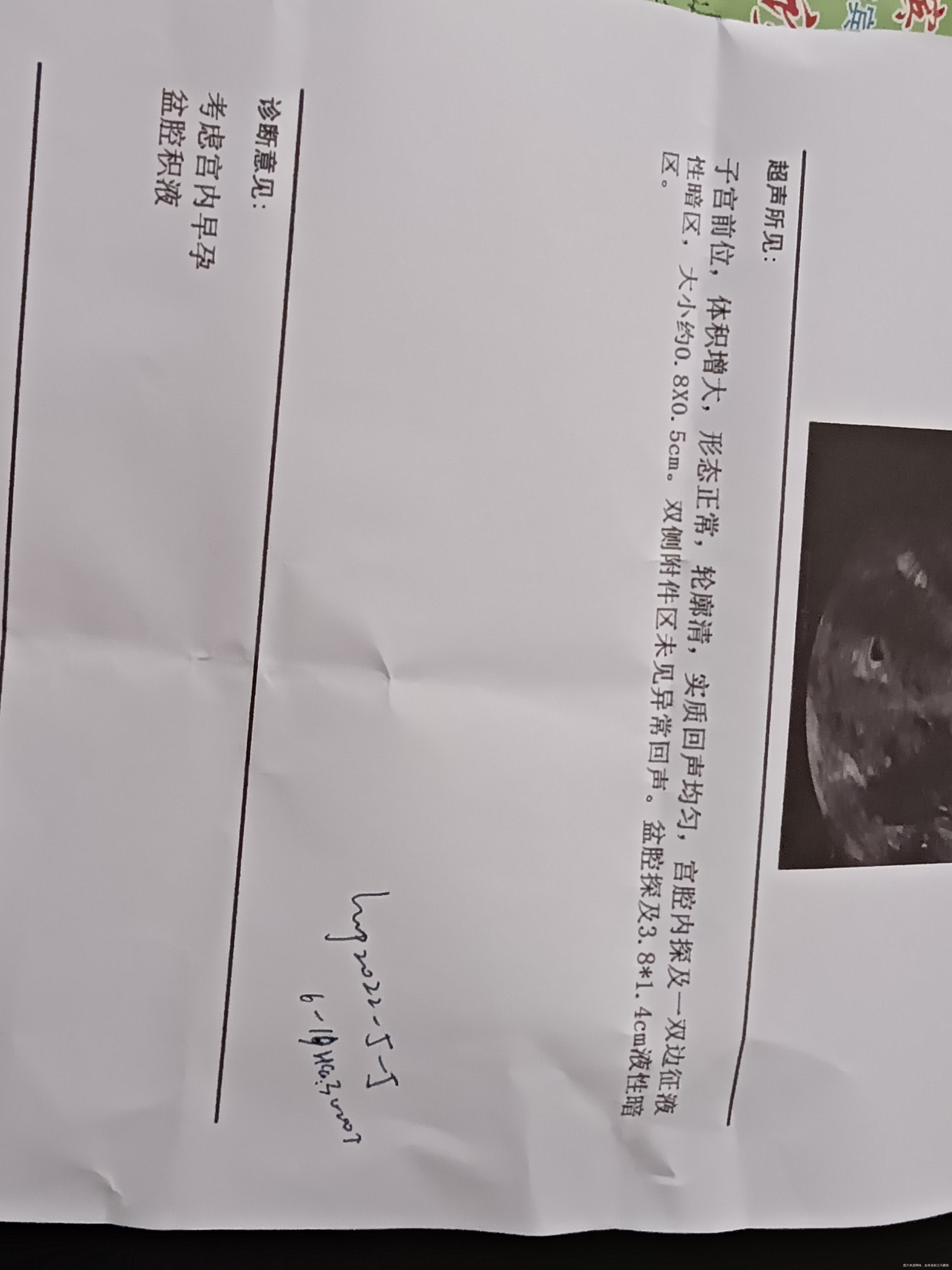 麻烦医生帮我看一下检查单