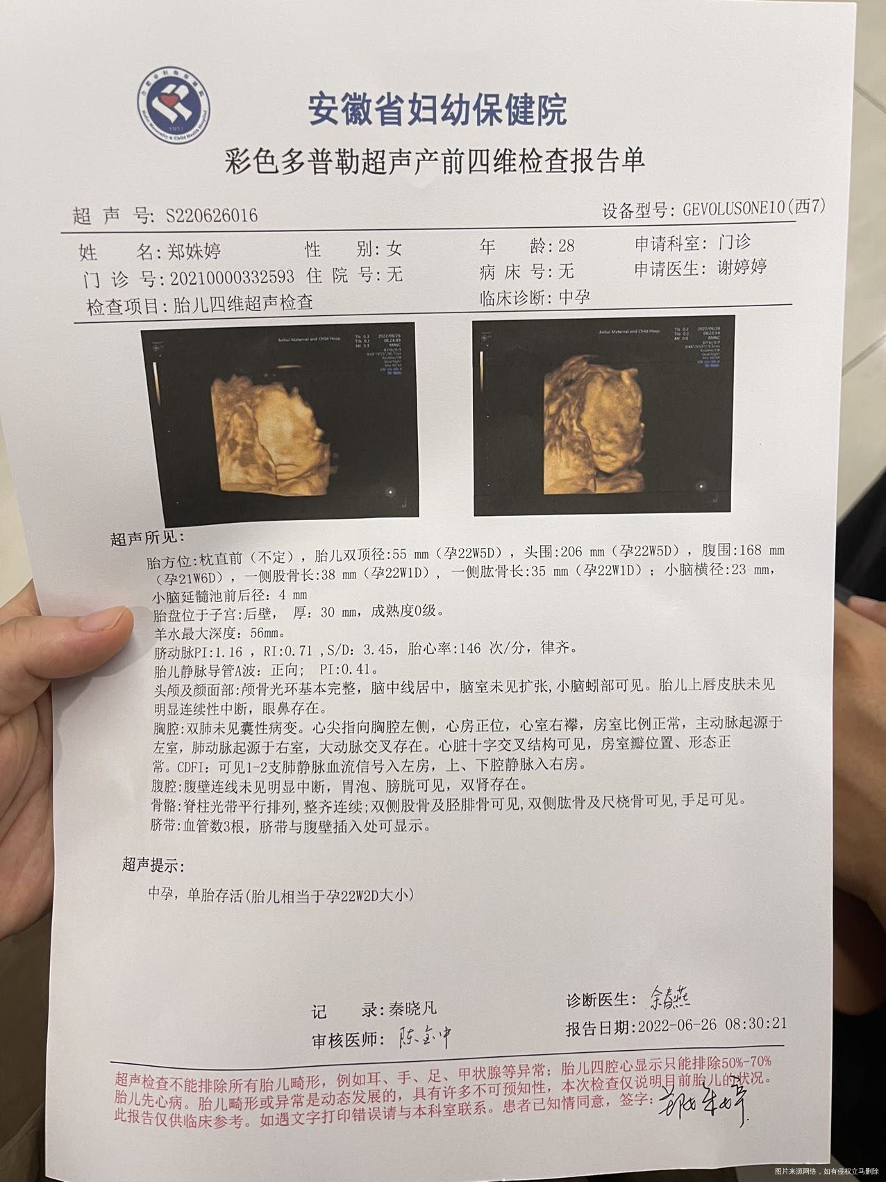 医生您好我是孕23周➕2做的四维显示偏小一周