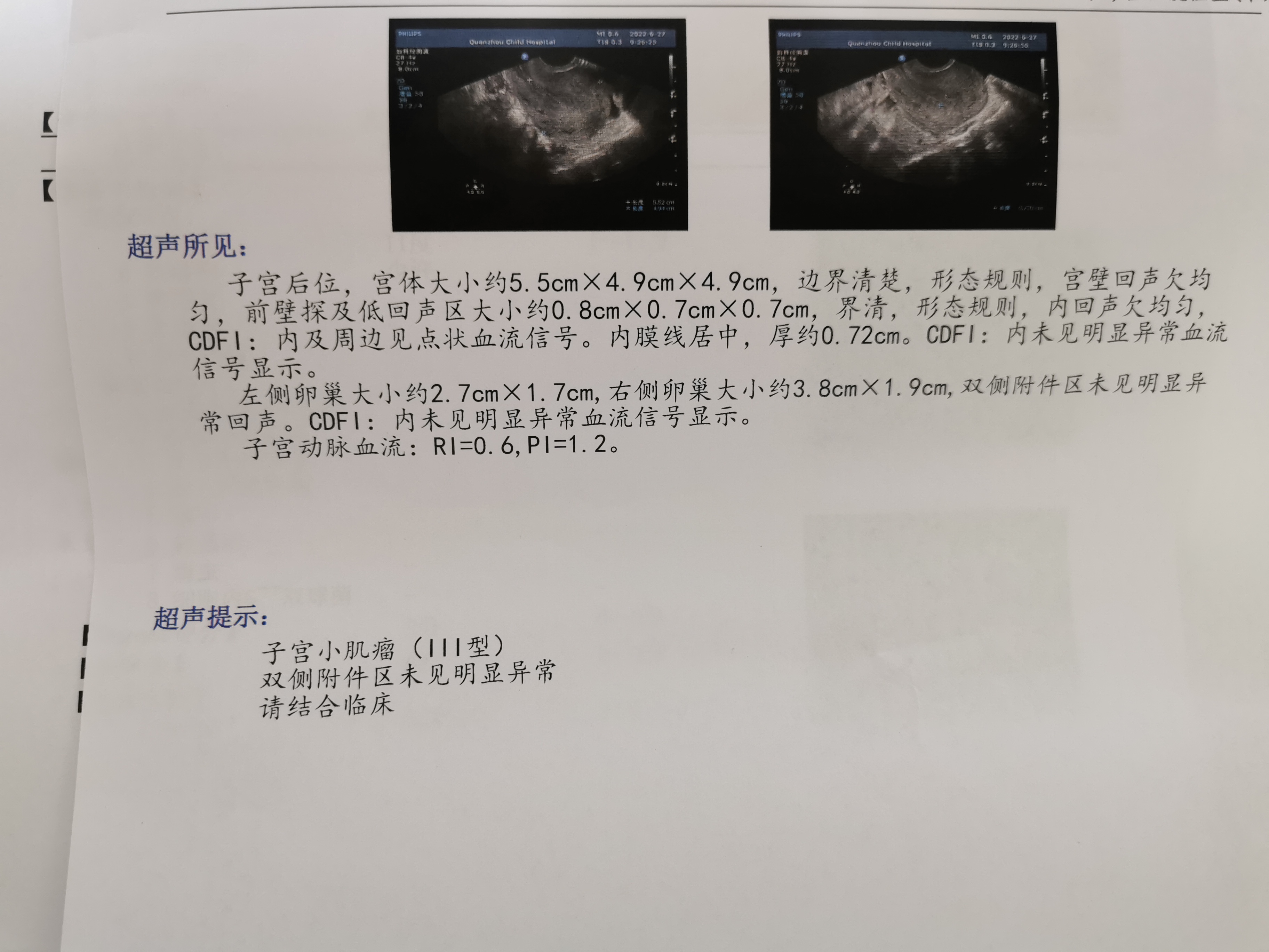 524宫腔镜手术525晚上来月经同时吃芬吗通