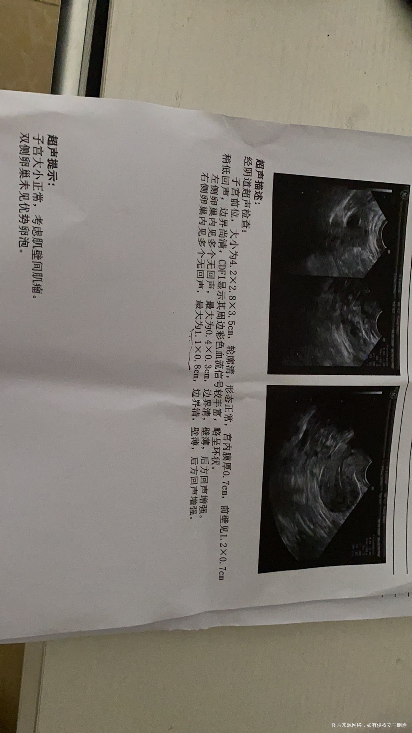 我今年2月份做了宫腹腔镜原因是双侧输卵管积水