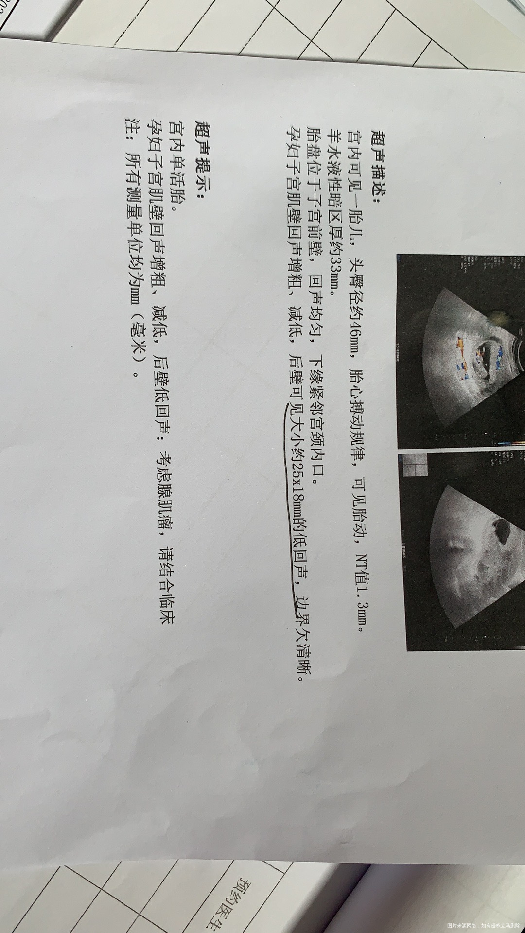 我又来了昨天做了nt现在又要考虑下一步做无创