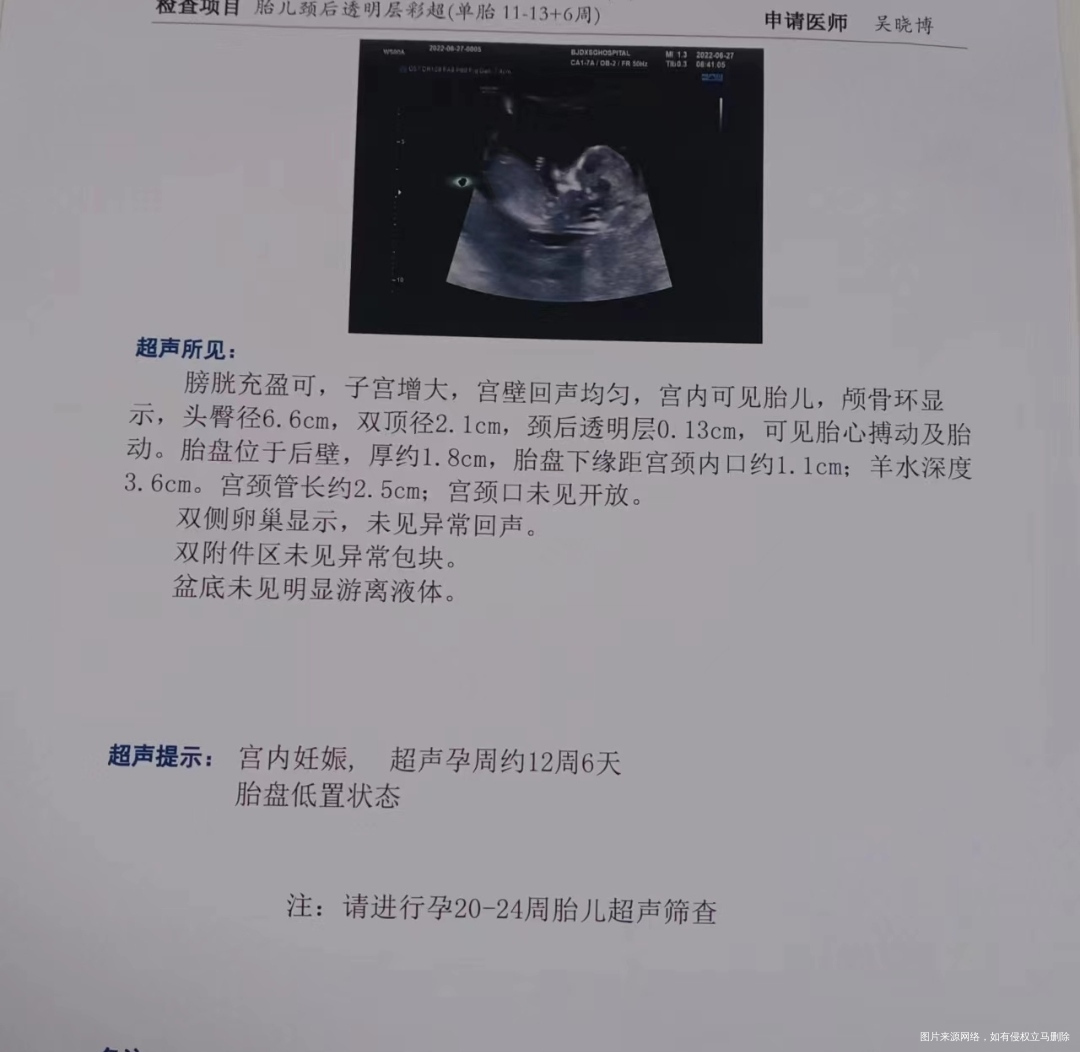 这个胎盘低点影响大吗