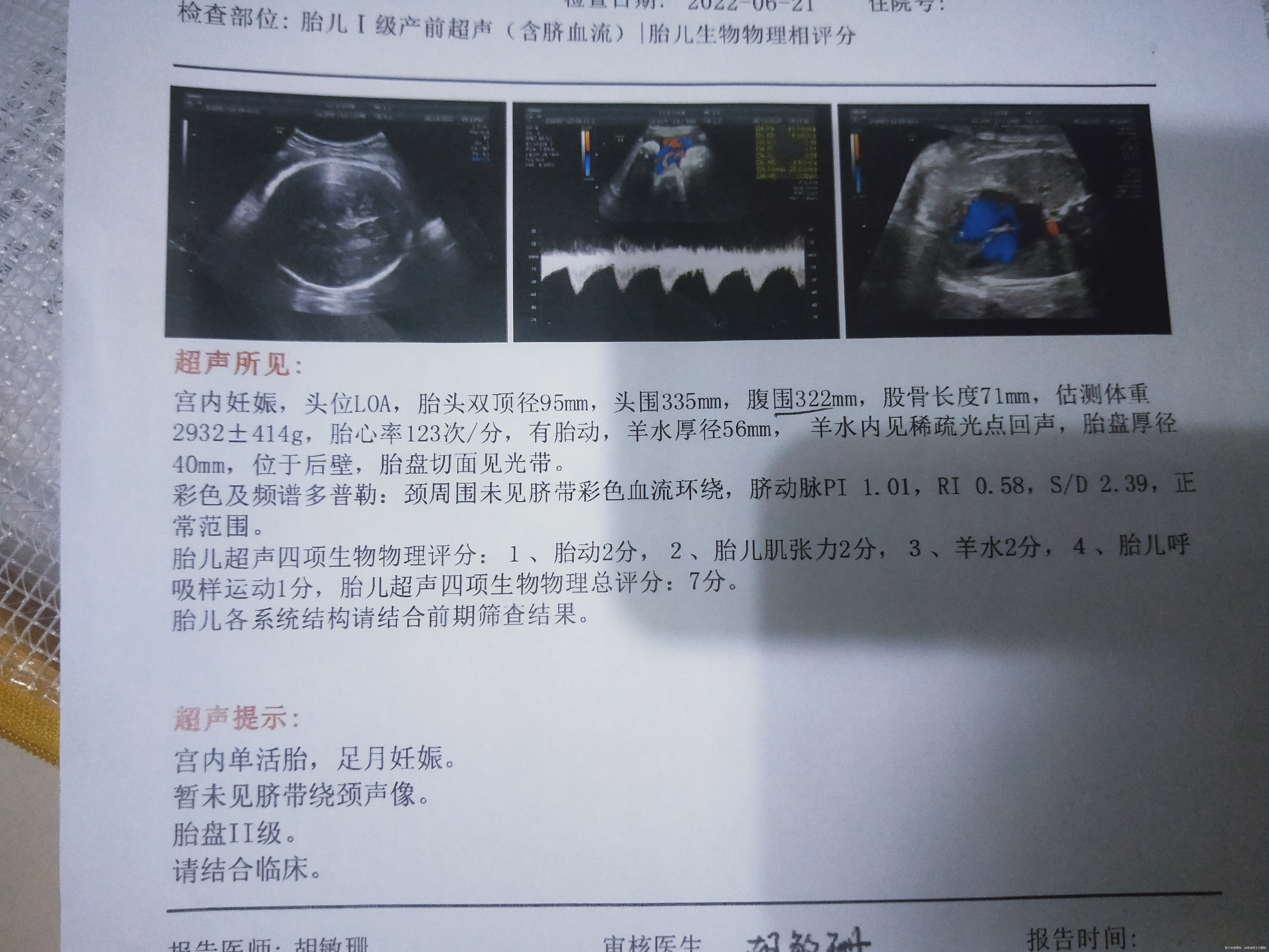 37周+2今天的b超数值正常吗之前说头大的我