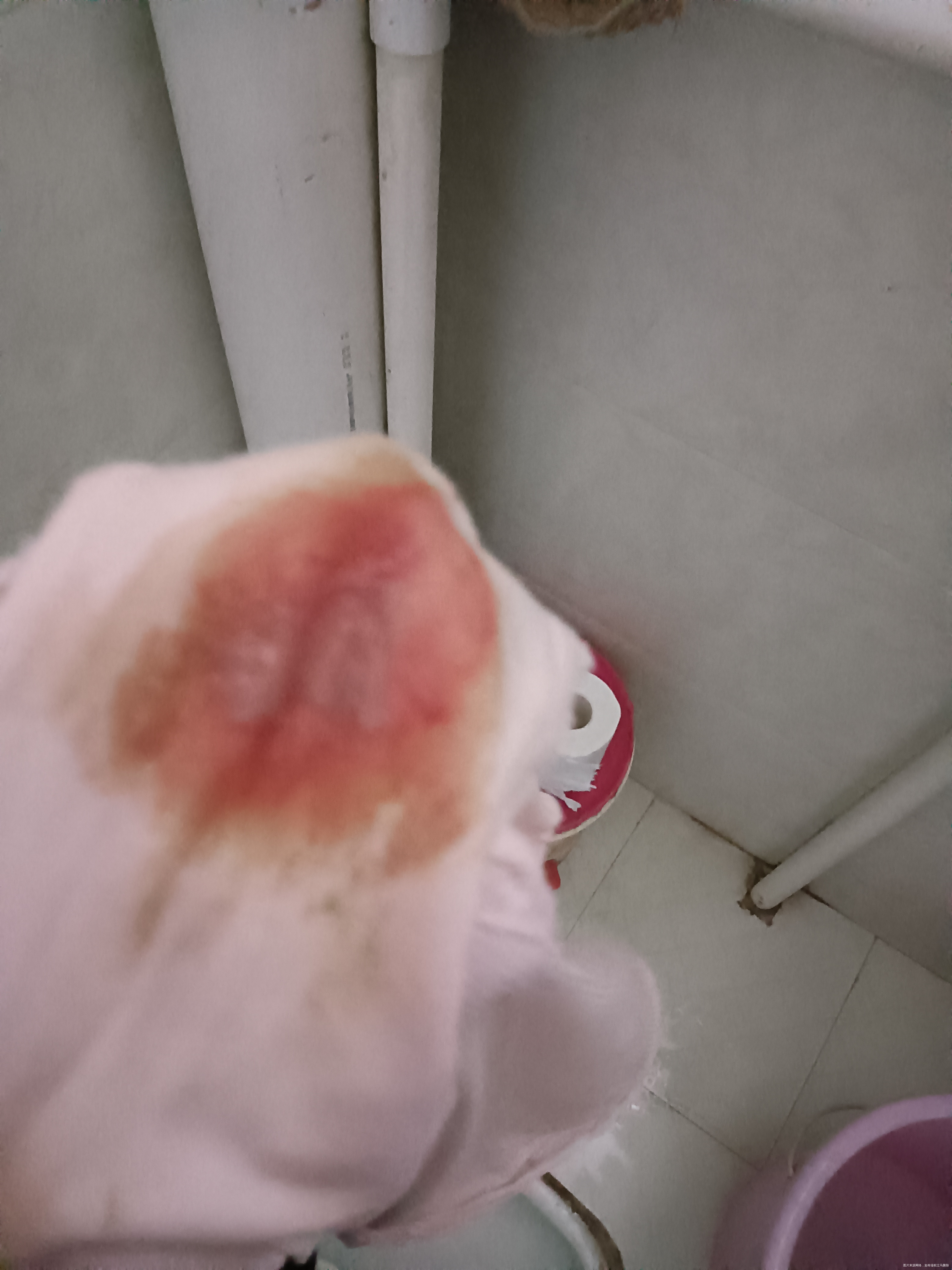 为什么会流这个脸色的血