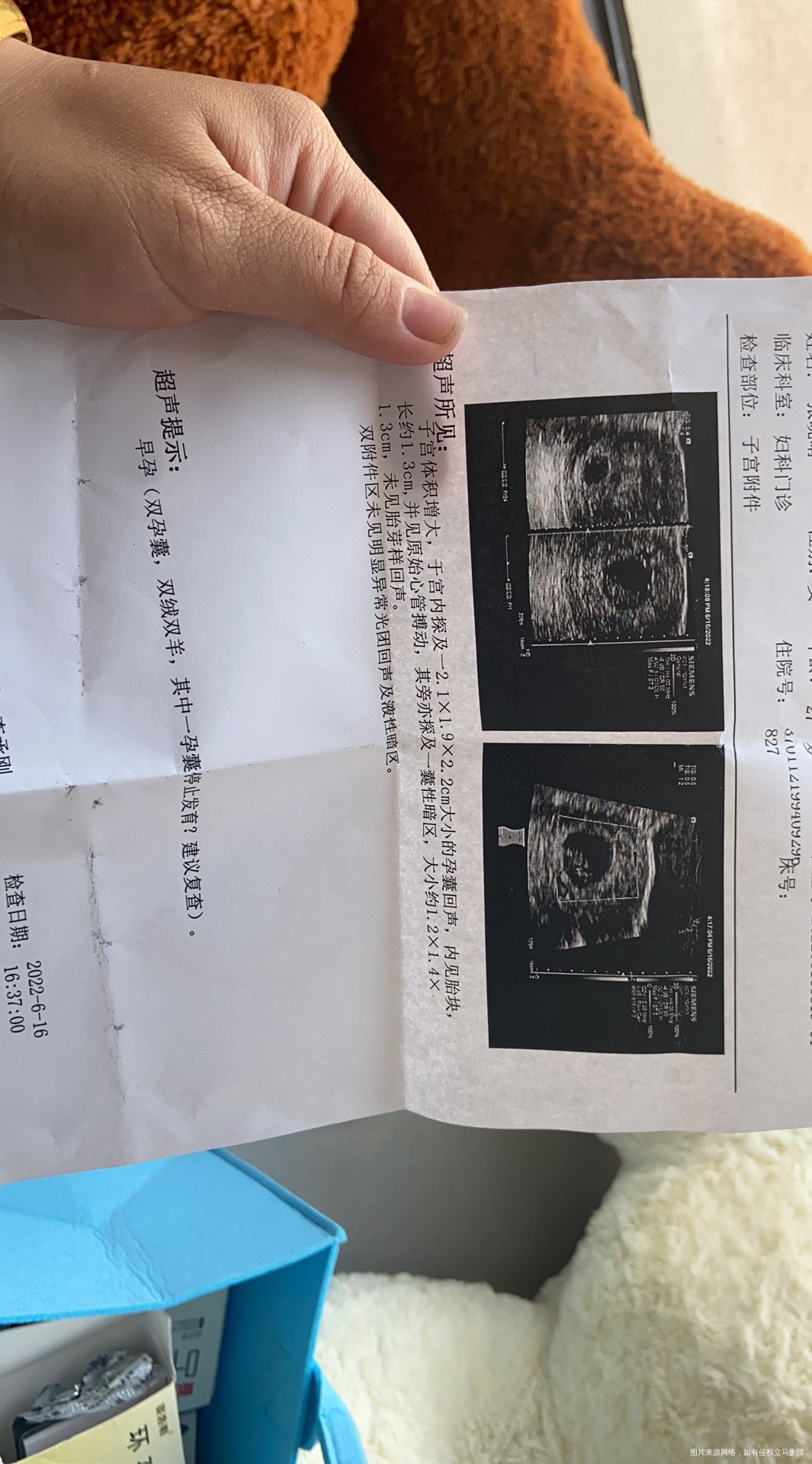 医生帮我看看我这个b超宫腔里有出血情况吗