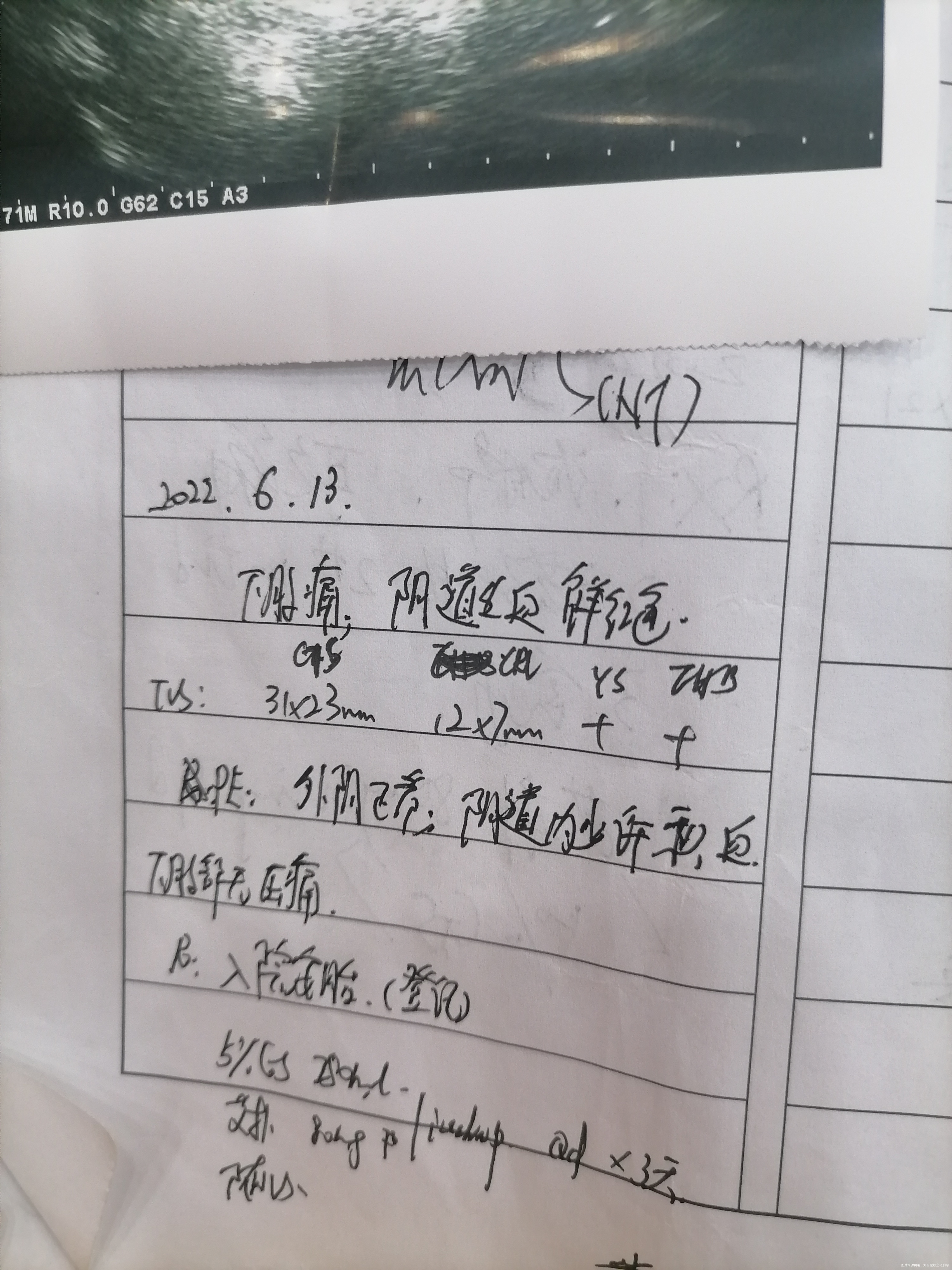 主任下面那个数字是什么意思我只听到GS是孕囊