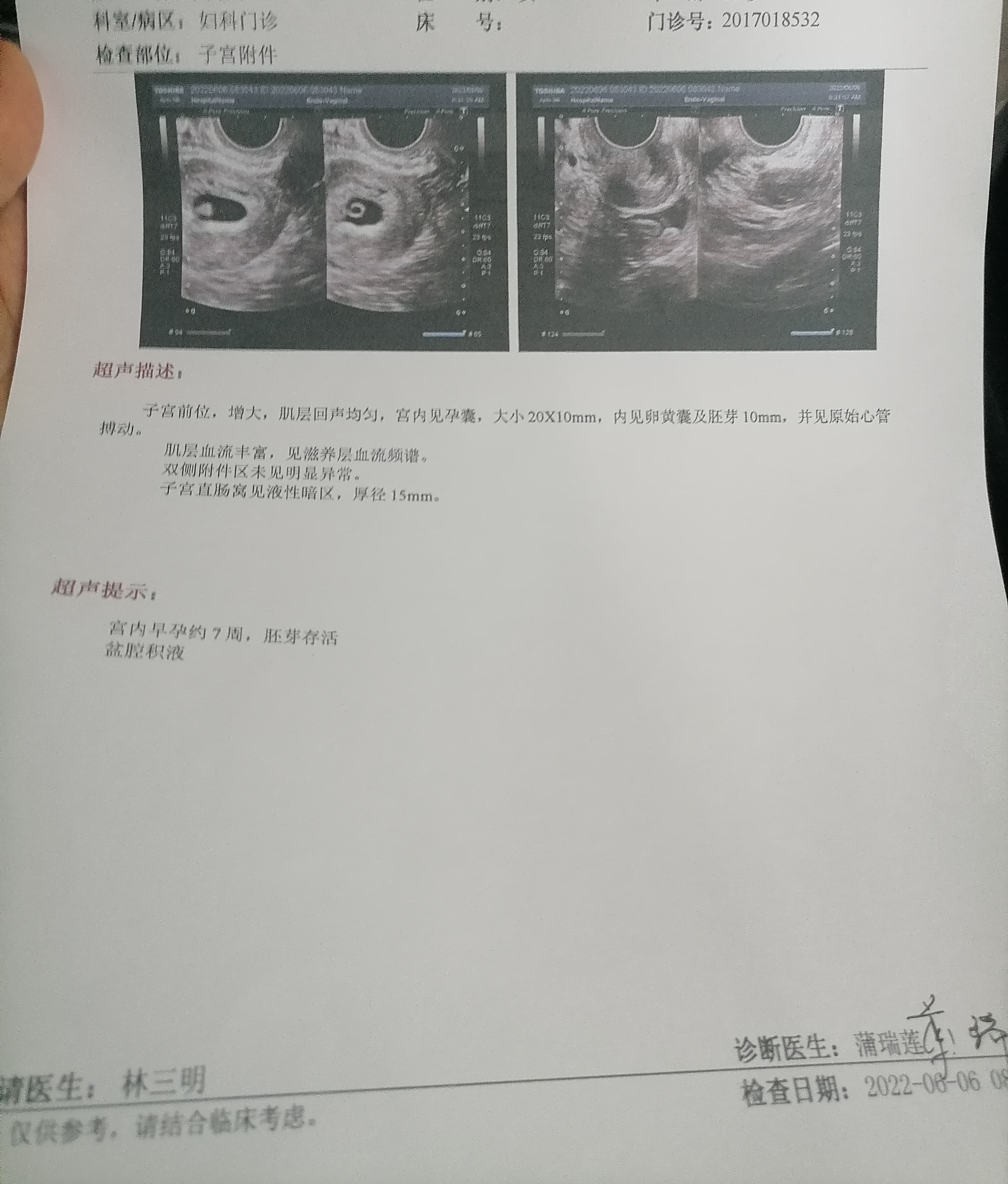 主任我明明才怀孕6周+2为什么写着7周了还有