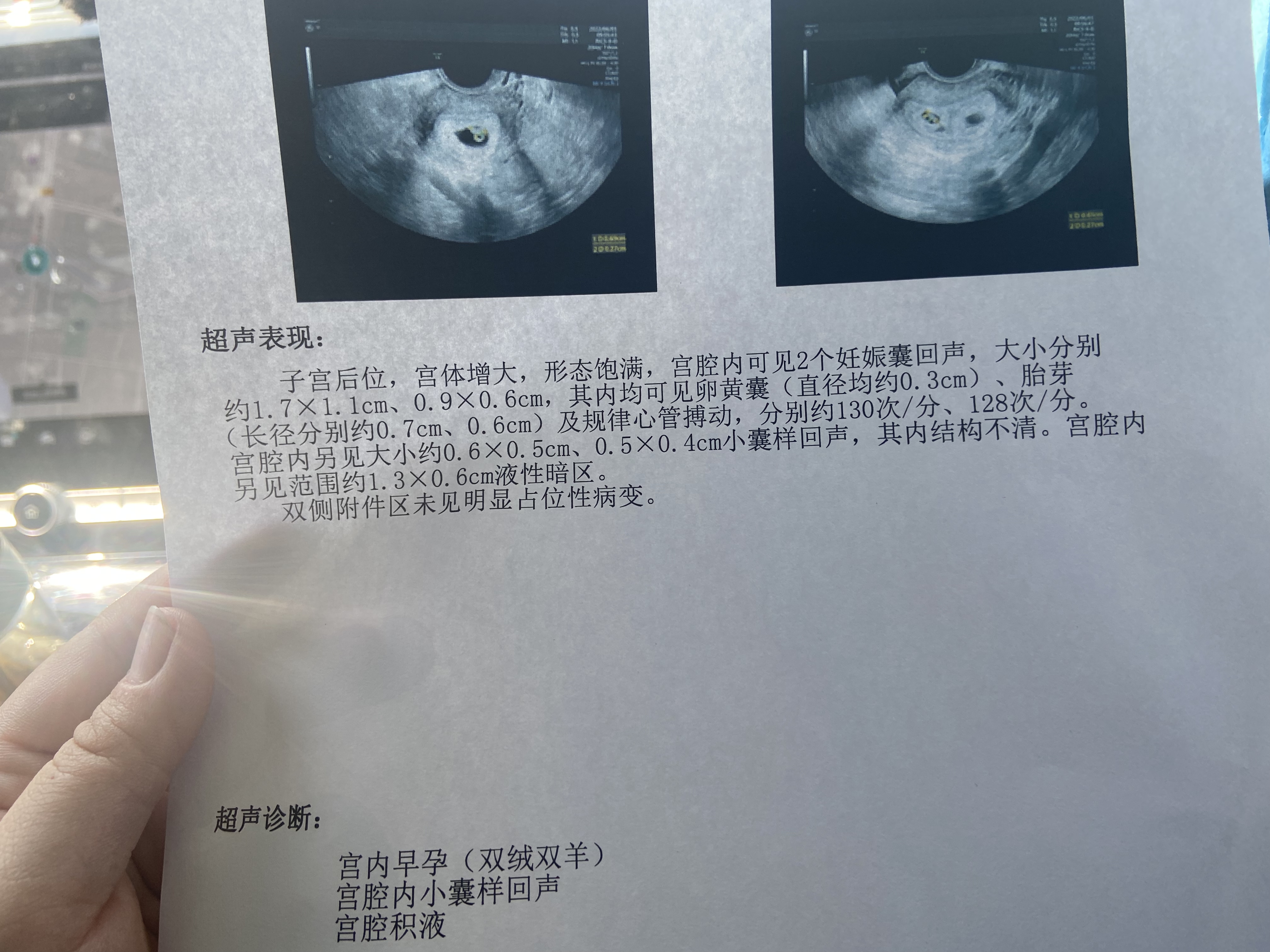 今天做了彩超结果怎么样麻烦医生帮忙分析一下
