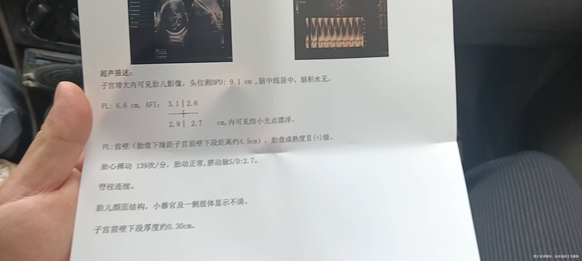 38周羊水多少正常这张单子羊水平均值是多少会