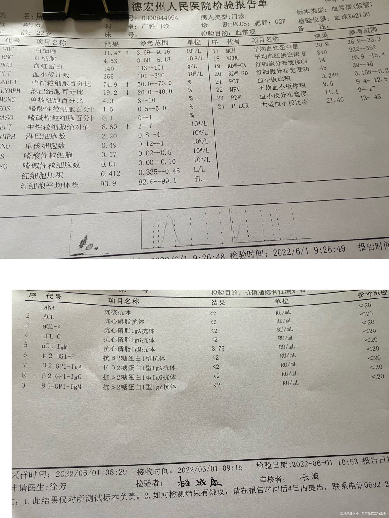 多囊促排怀孕有胎停史从怀孕就开始吃地屈孕酮片