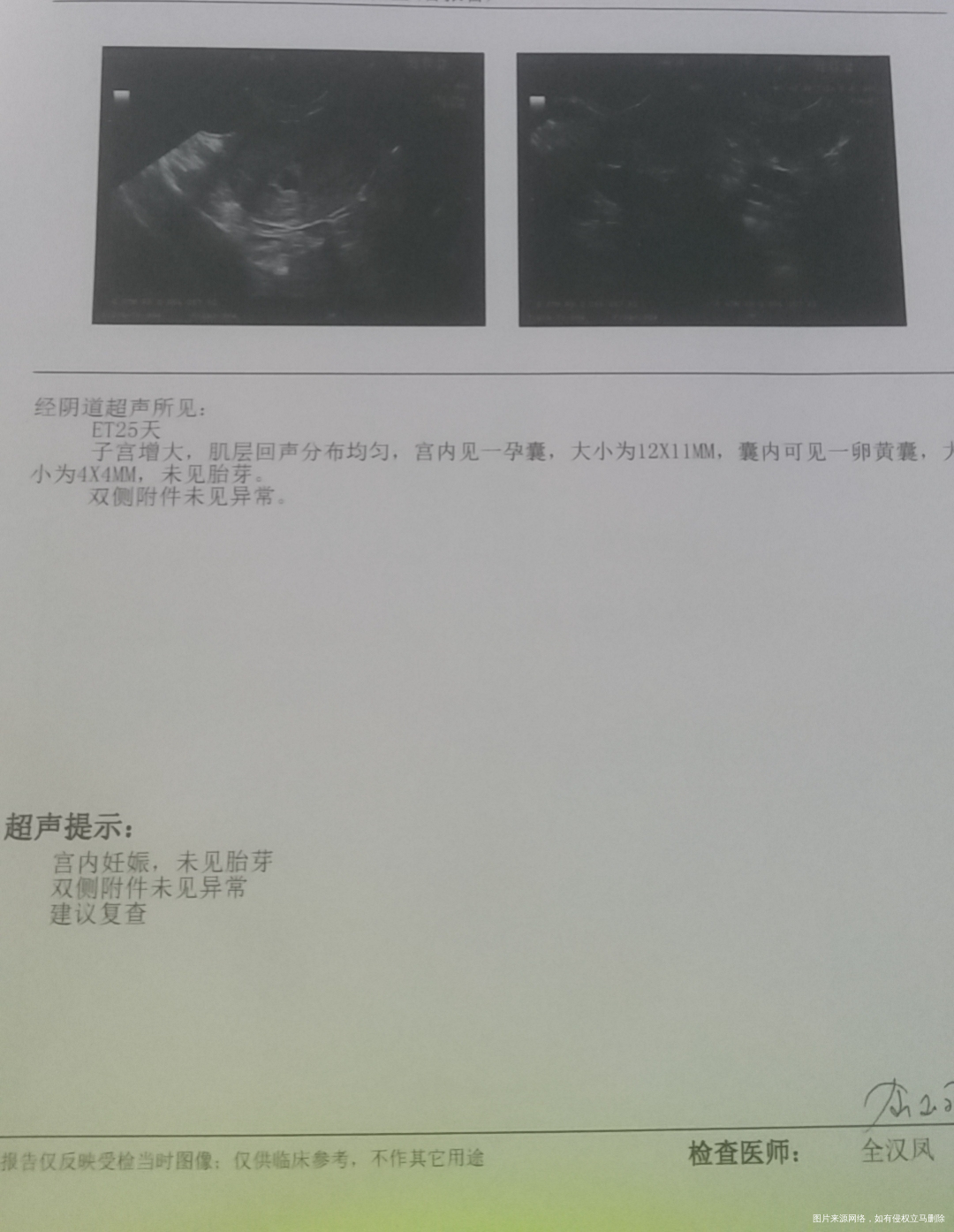 移植冻胚14天血值71117天220021天